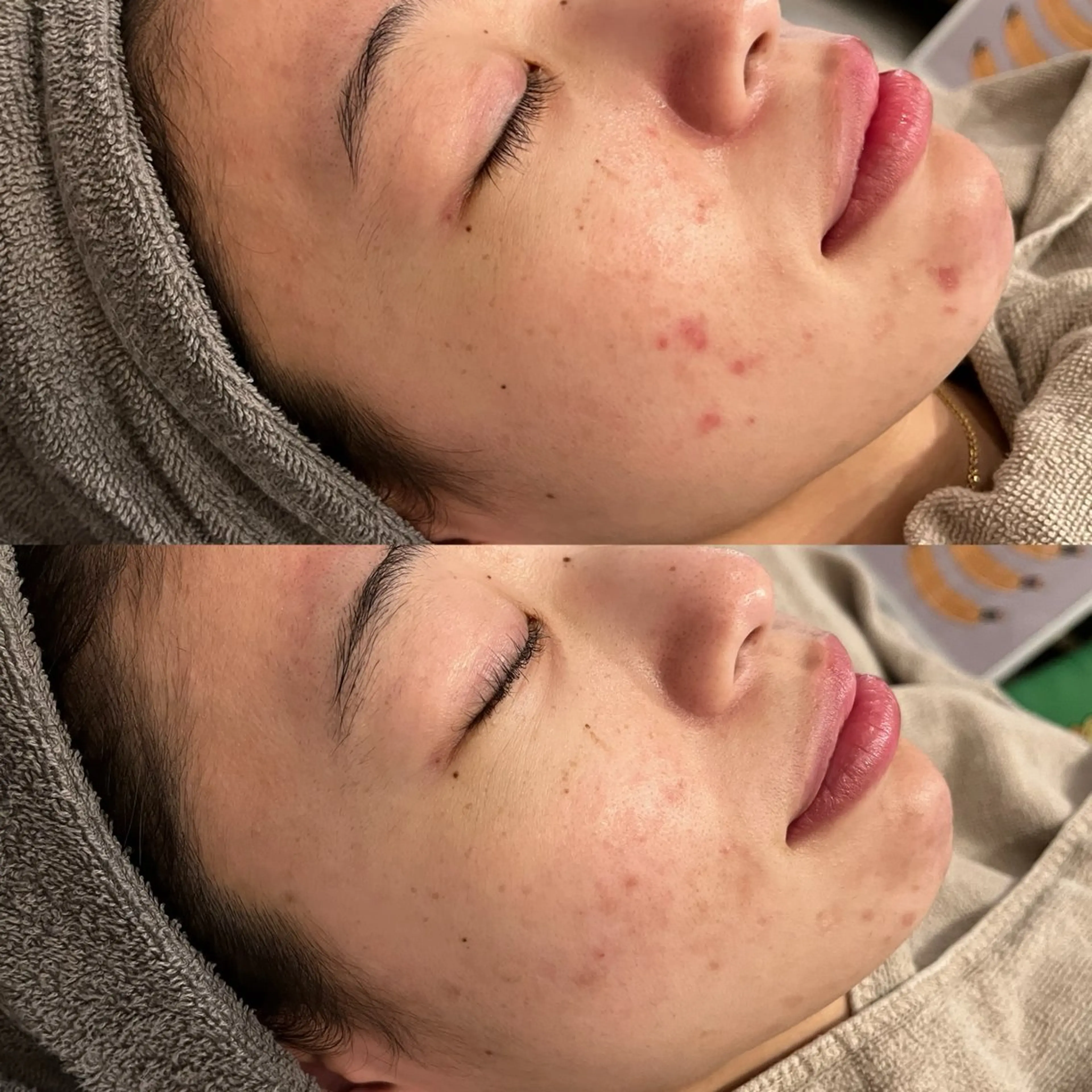 脱毛 yellow💛【 脱毛&フェイシャル】のエステ・リラクイメージ