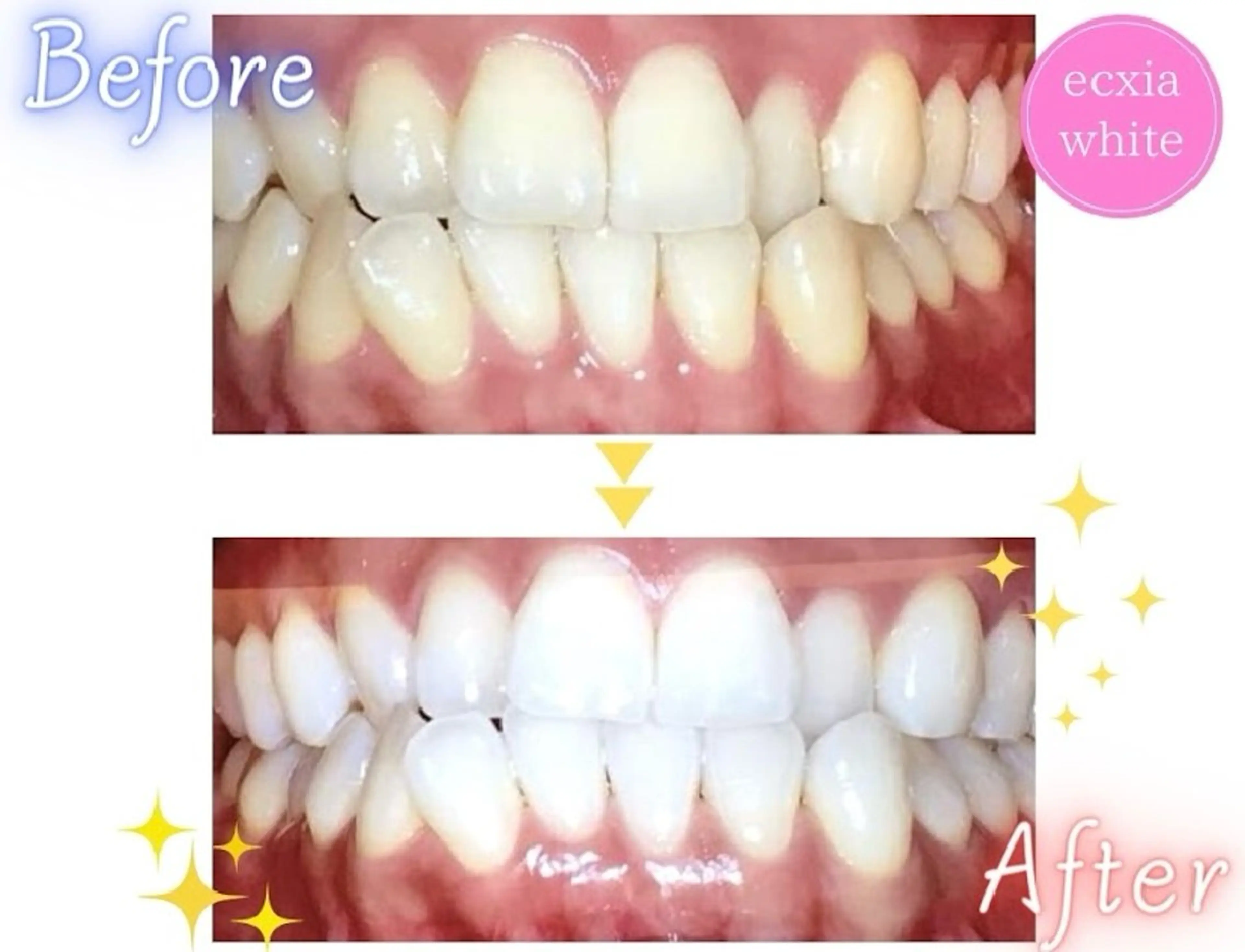 セルフホワイトニング エクシア前橋店のその他イメージ