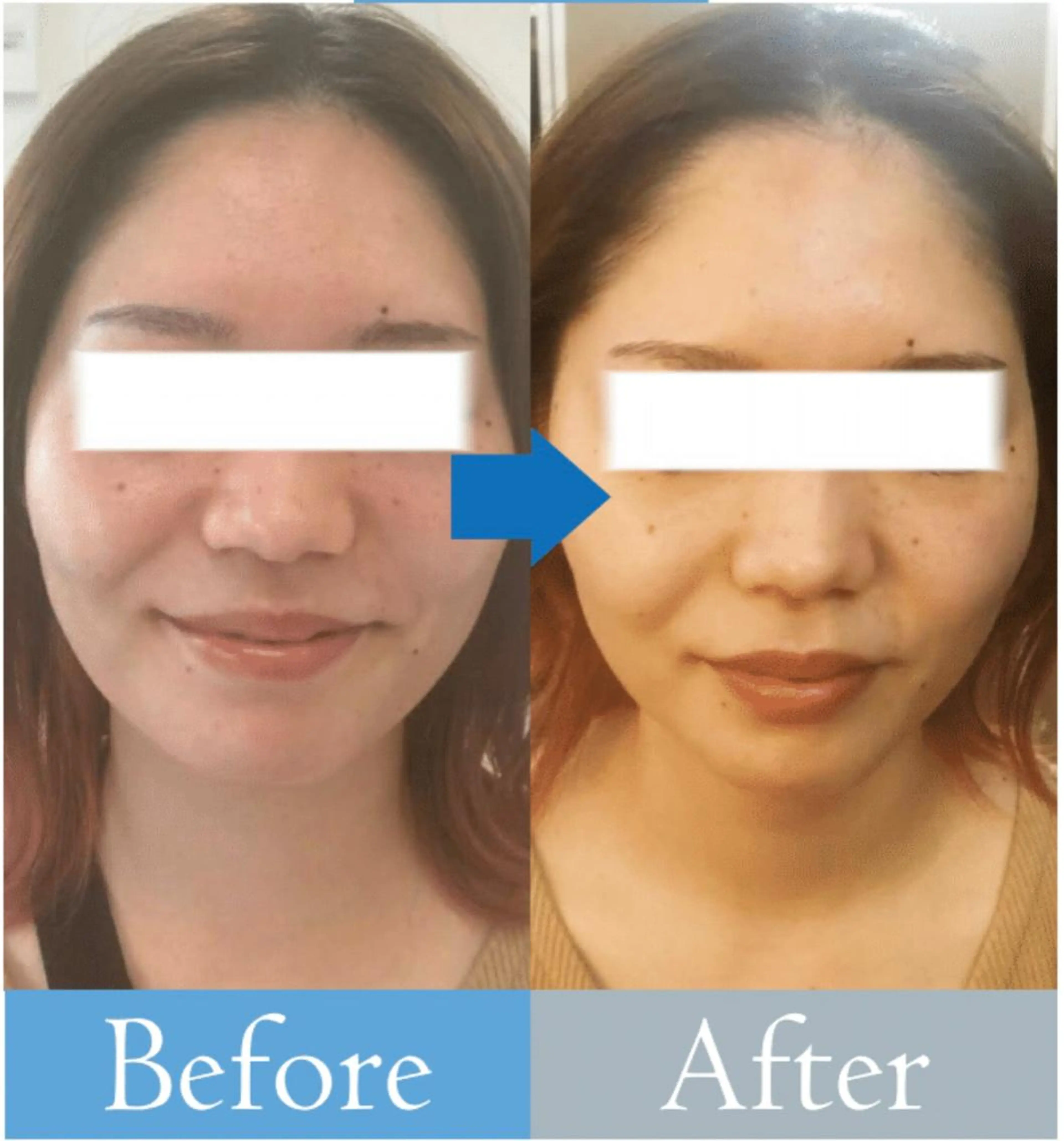 【医療提携エステ】 ルミナス北浦和のその他イメージ