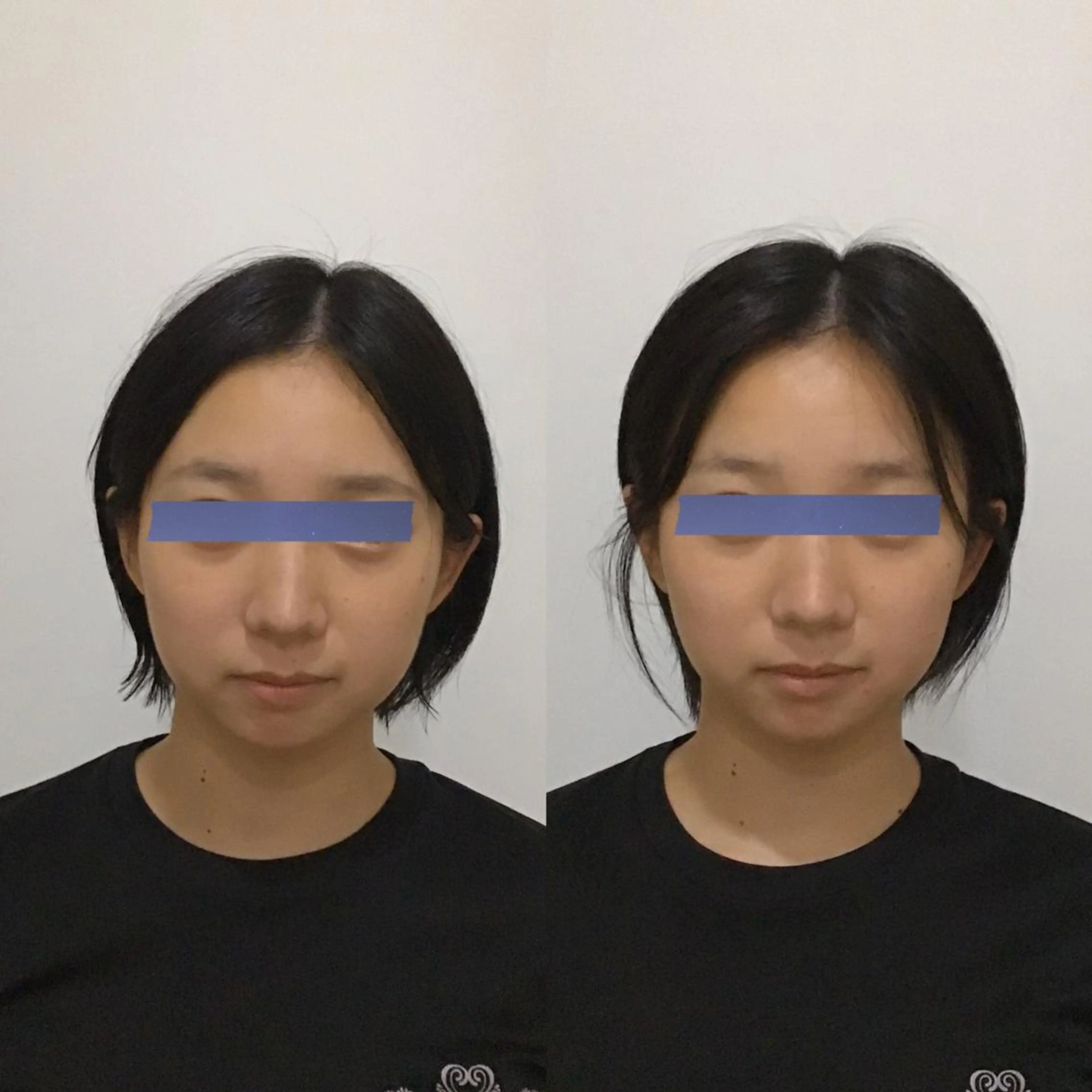 姿勢・骨盤/小顔矯正 痩身ダイエット 横田のエステ・リラクイメージ