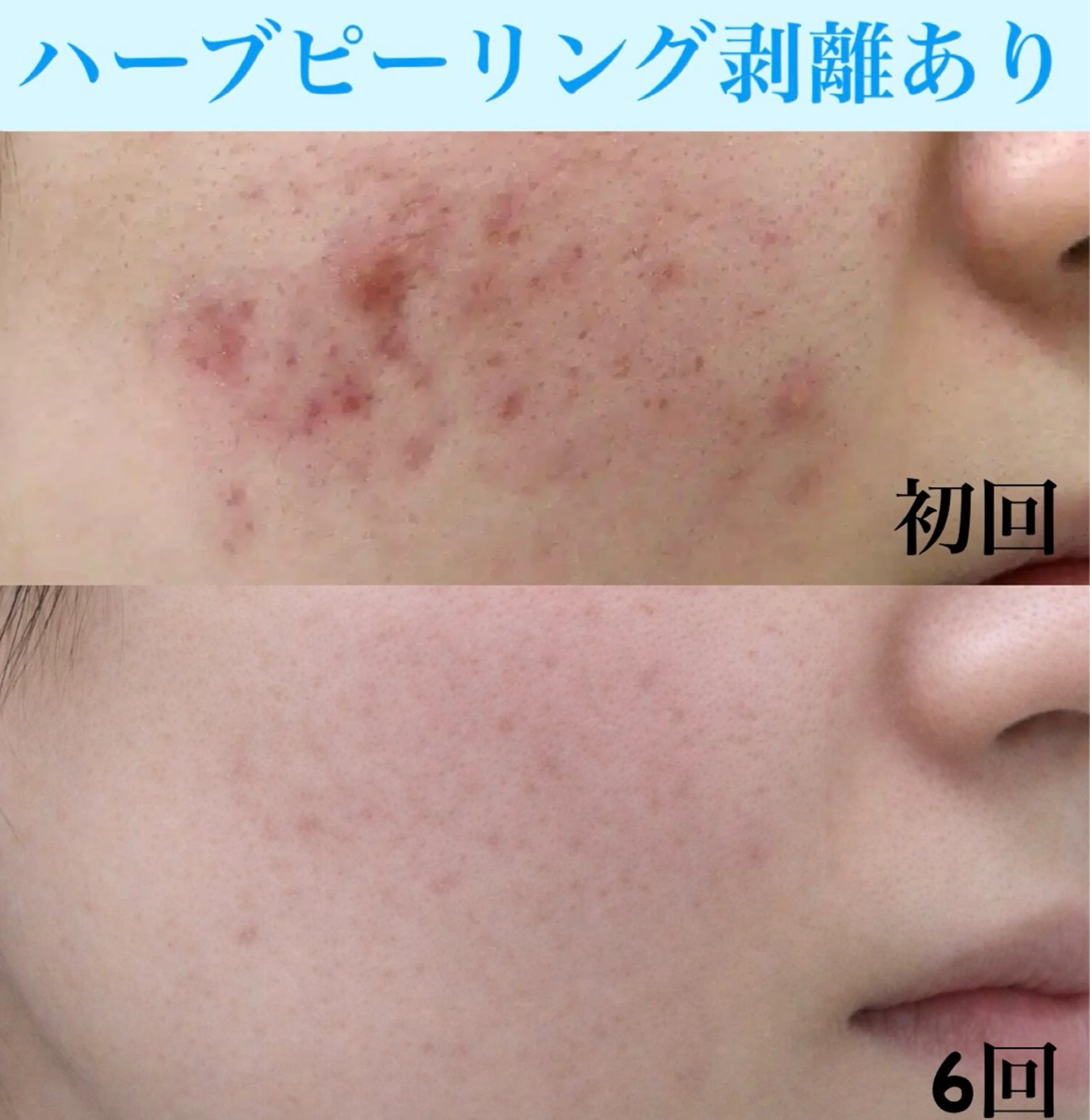 エステ Soin 身体＆お肌ケアのエステ・リラクイメージ