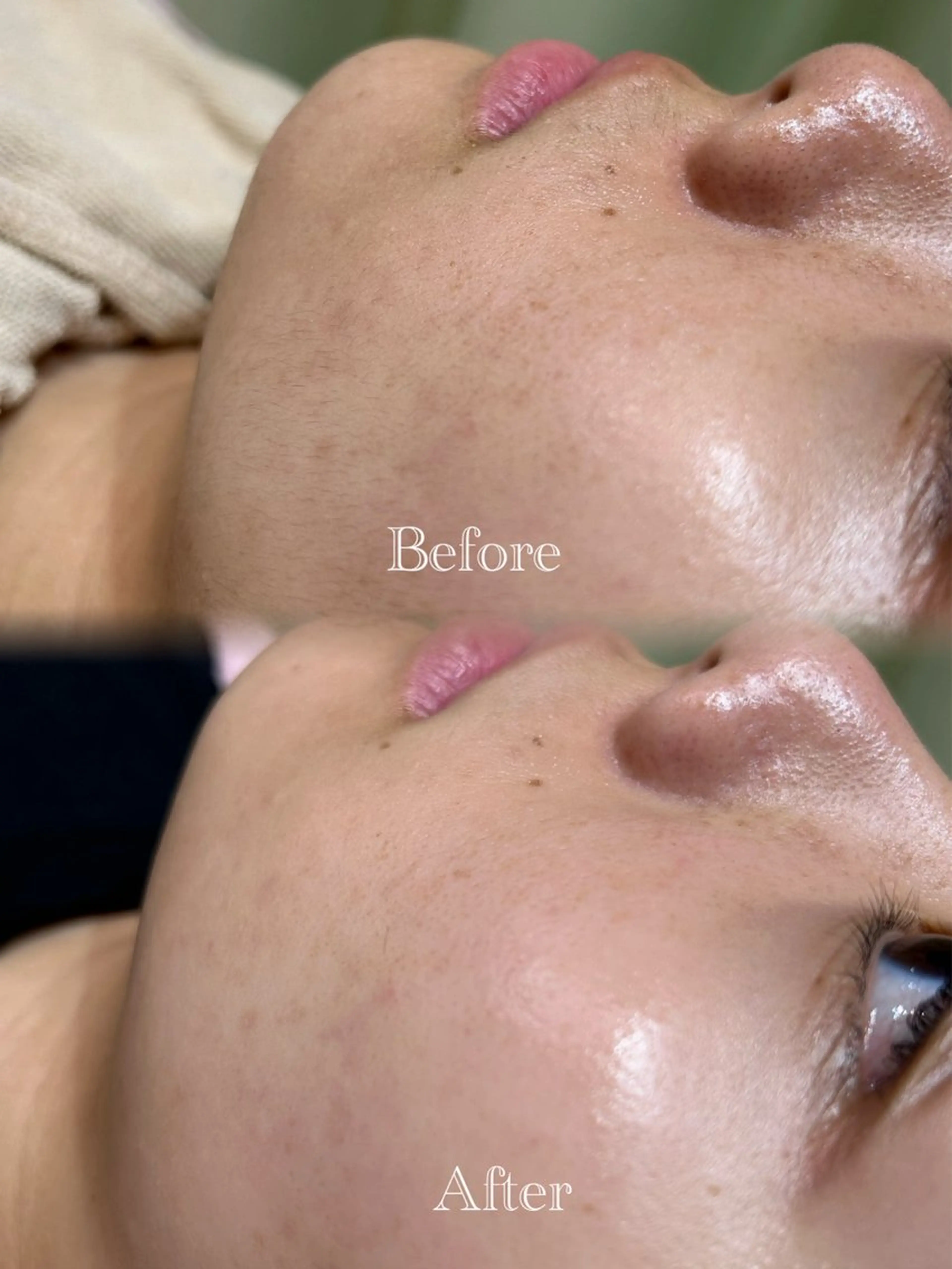 🫧美しい素肌へ🫧 今成柚乃のその他イメージ