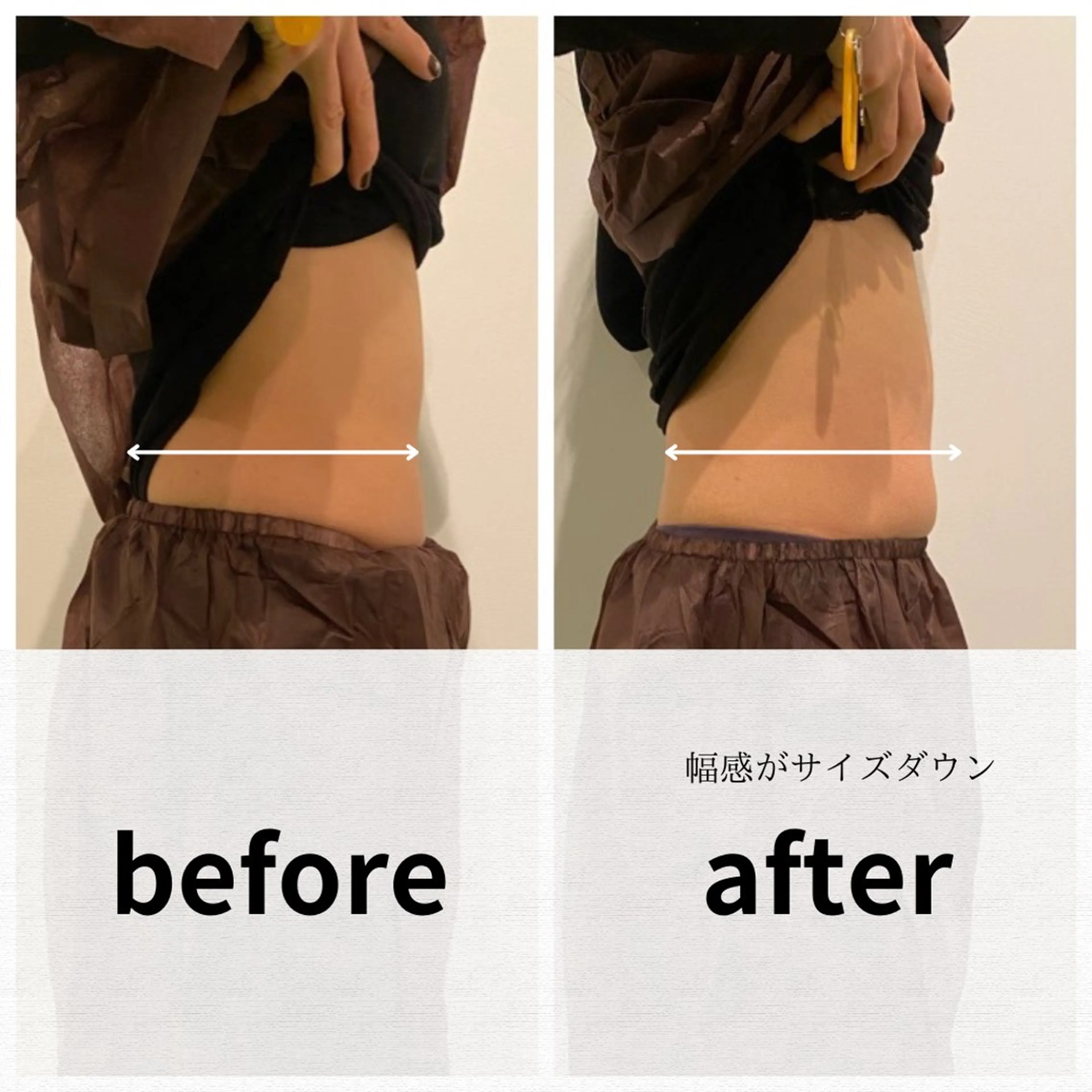 美容鍼/ヘッドスパ/ 💎さかもとのエステ・リラクイメージ