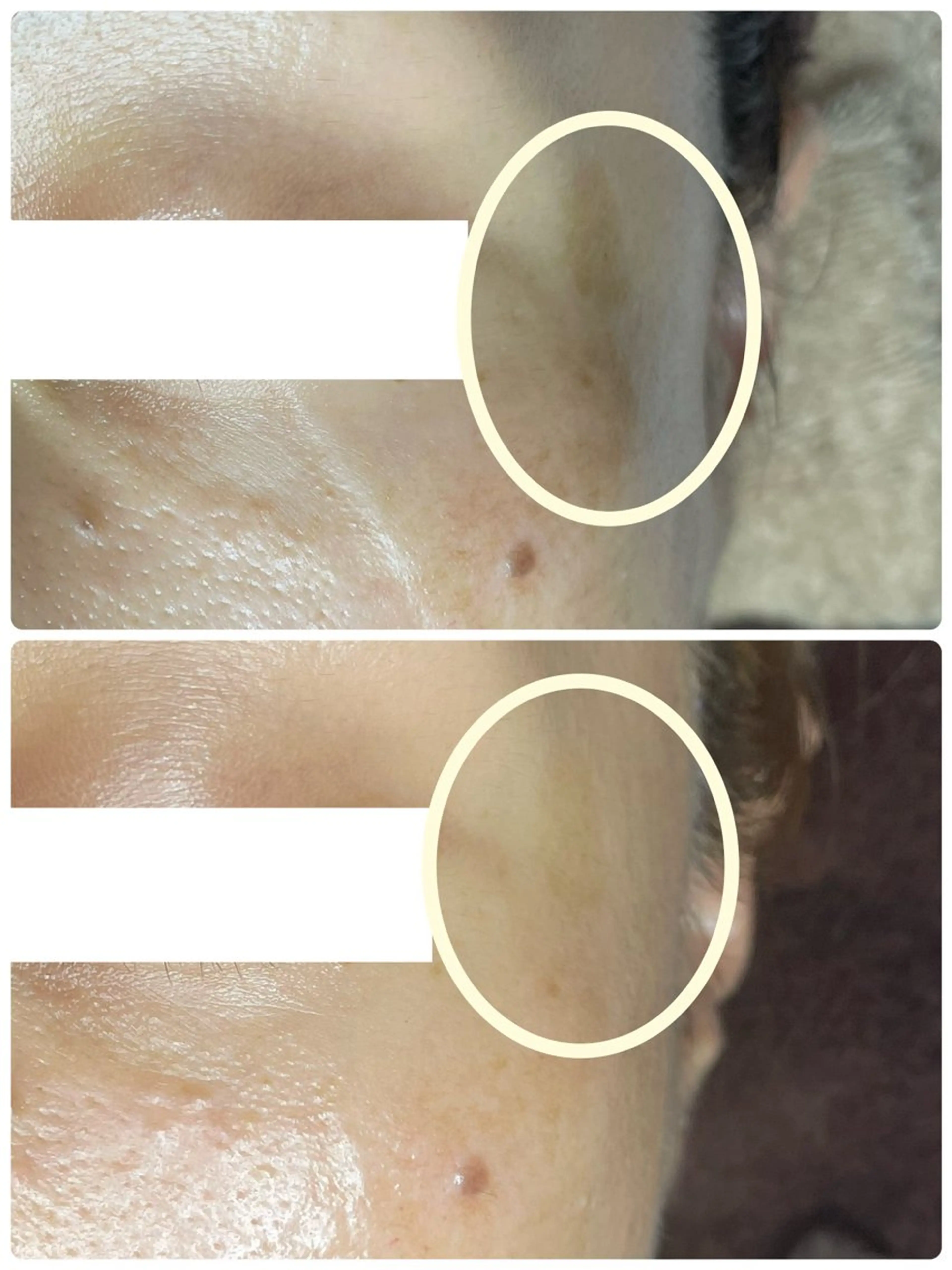 TIERRA(ティエラ)所属・TIERRA ♡のエステ・リラクイメージ