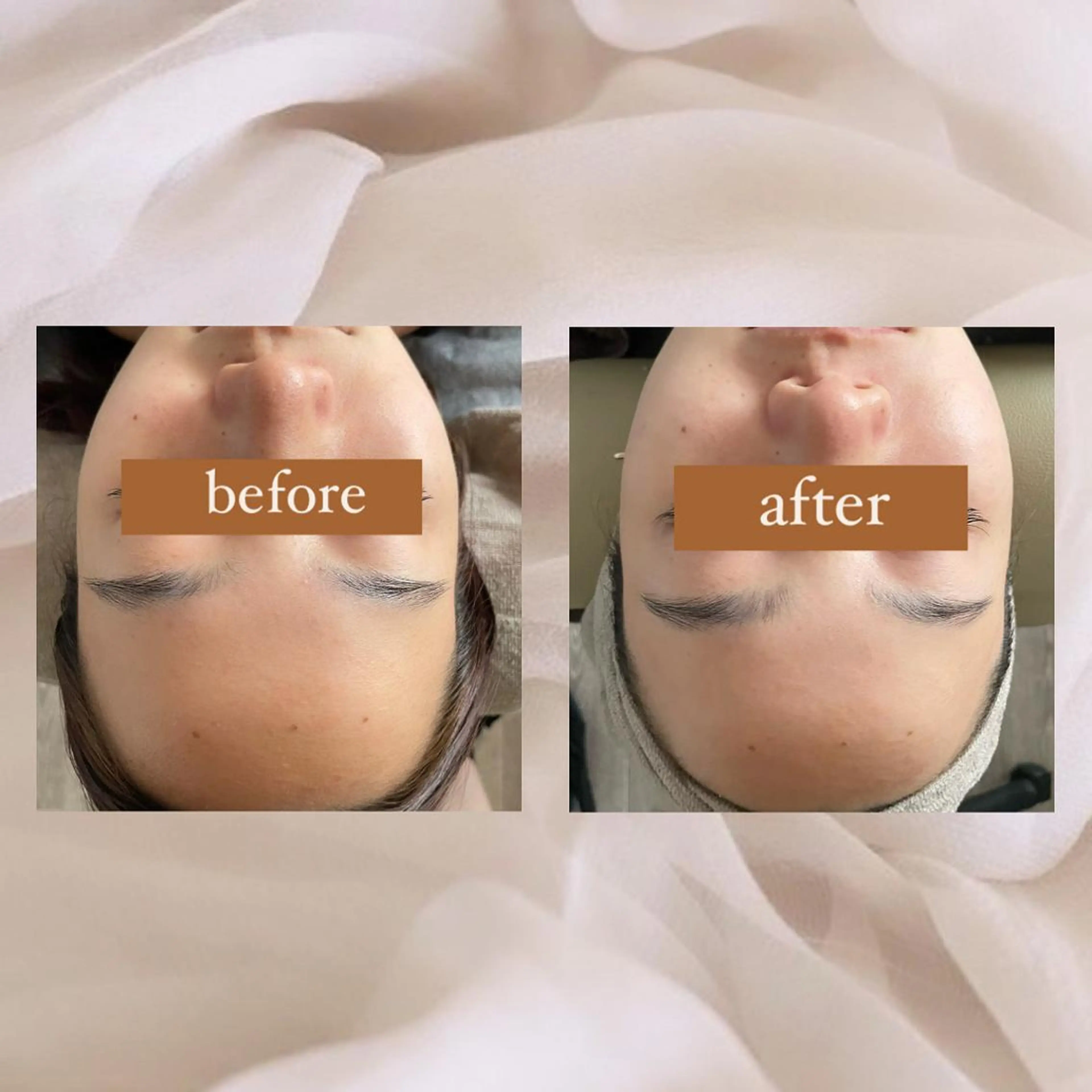 エステ 【韓国肌管理・脱毛】 クレセントのその他イメージ