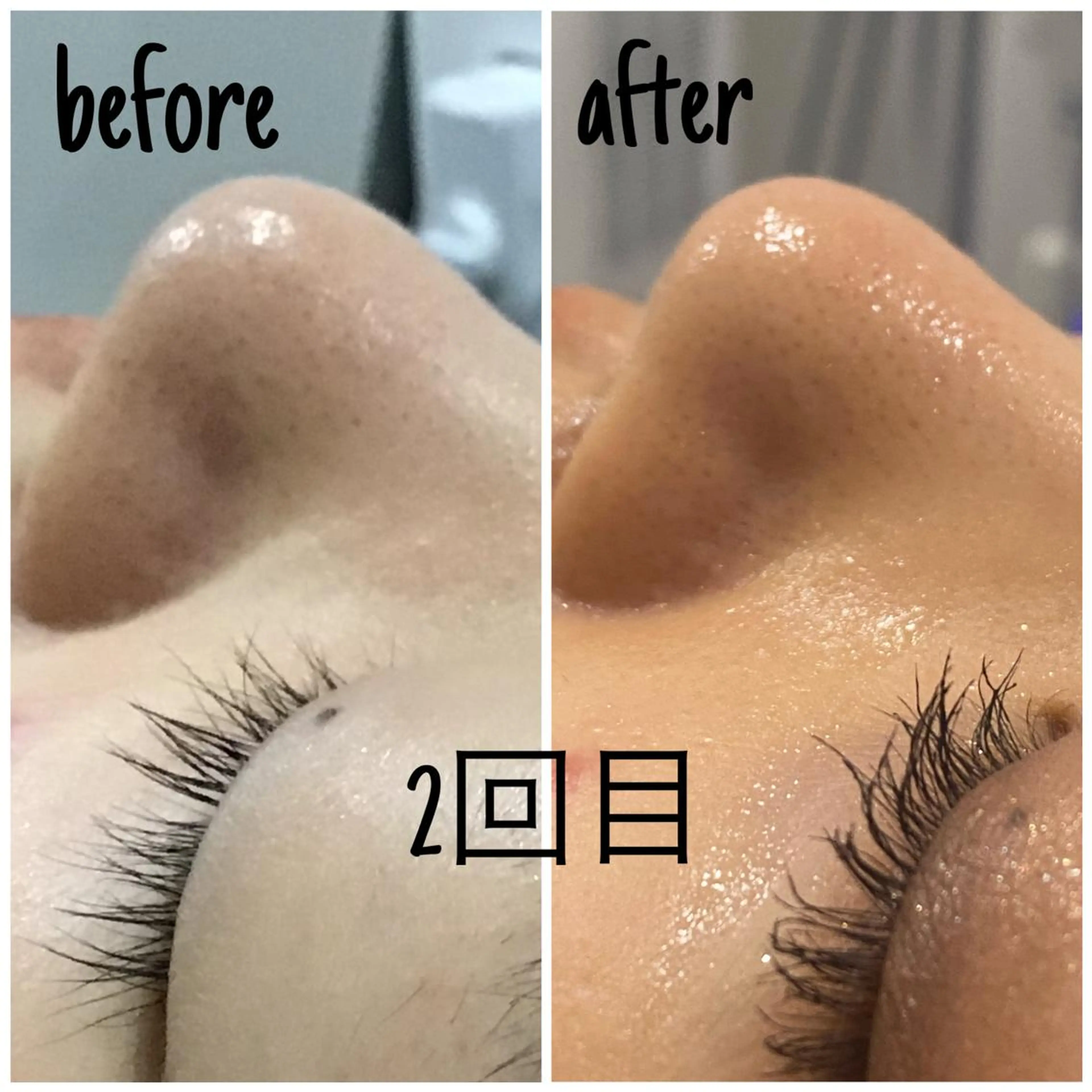 エステ 毛穴洗浄・痩身・脱毛 /アルカンジュのエステ・リラクイメージ