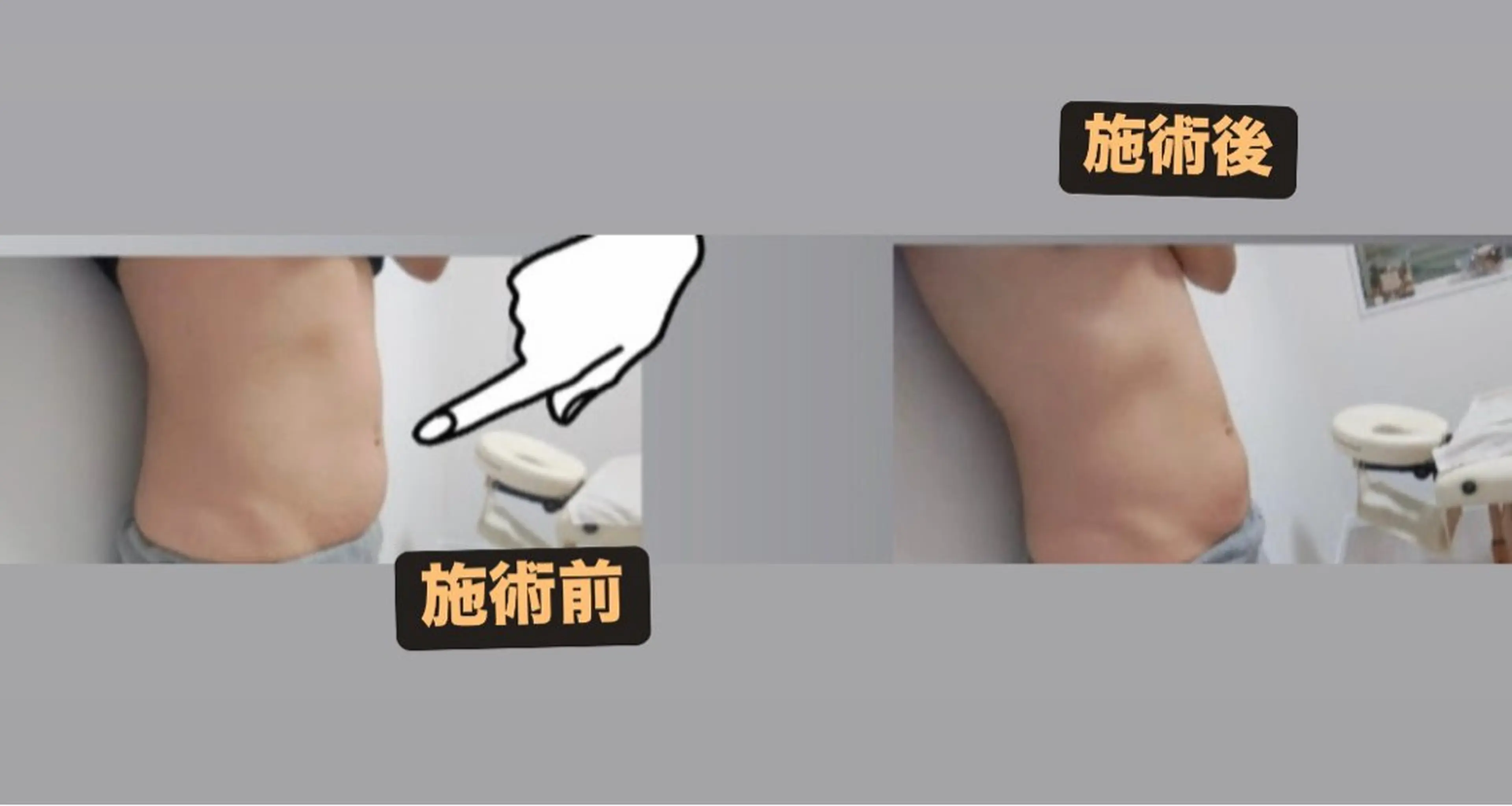 代謝アップ，浮腫み， 体質改善のエステ・リラクイメージ