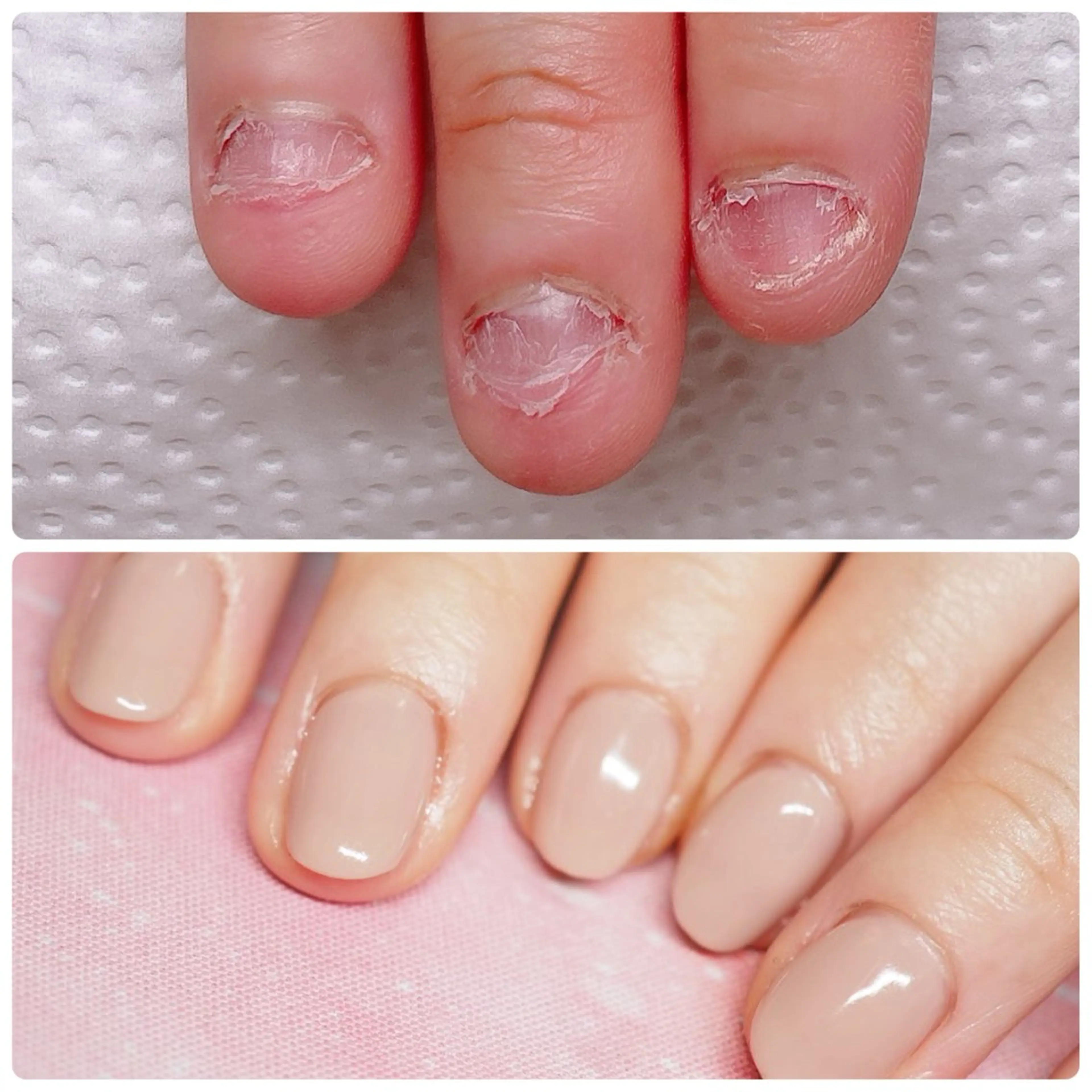 ネイル ハンドネイル 深爪を断らない スカルプ高評価店のネイルデザイン