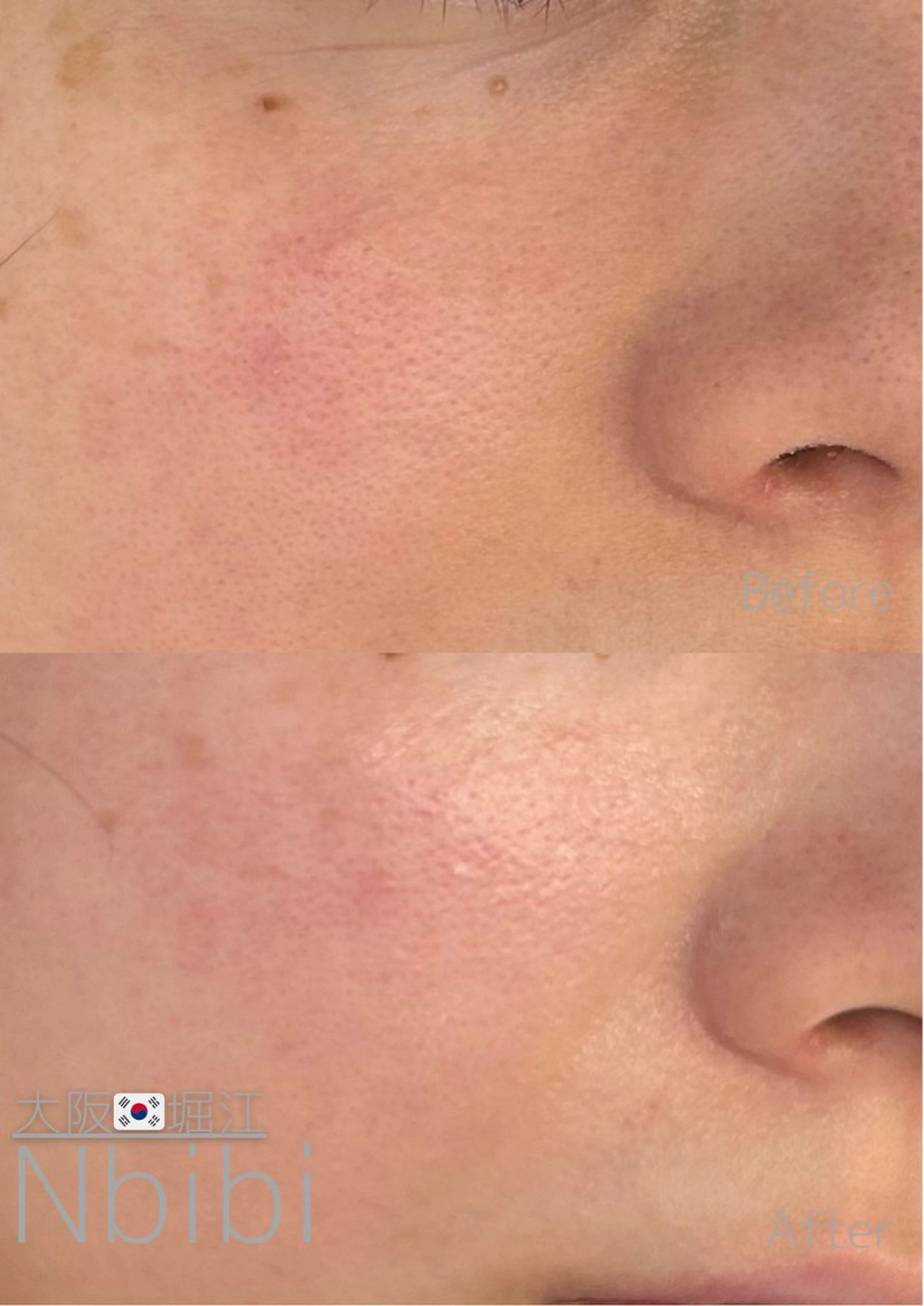 エステ 韓国🇰🇷価格 サロン_Nbibiの眉毛・アイブロウイメージ