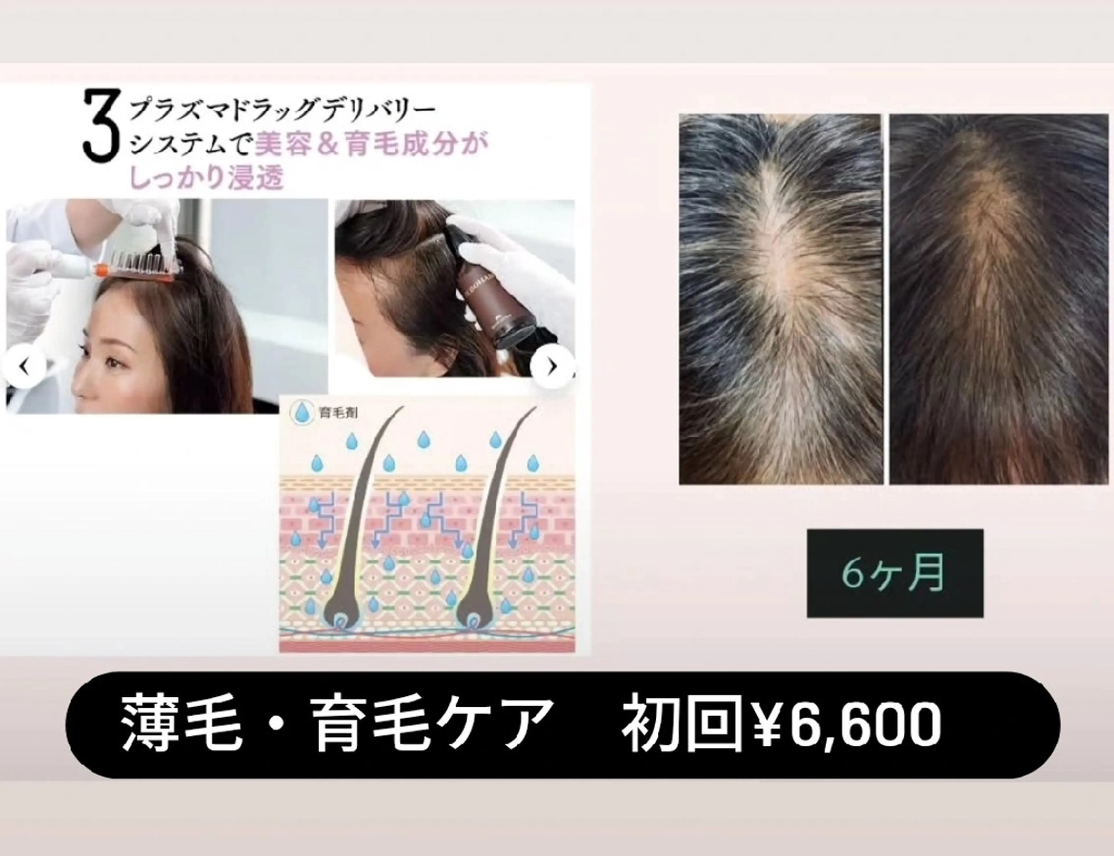 ユニセックスエステサロンUniclear所属・佐賀痩身エステ/小顔 @uni.clearのエステ・リラクイメージ