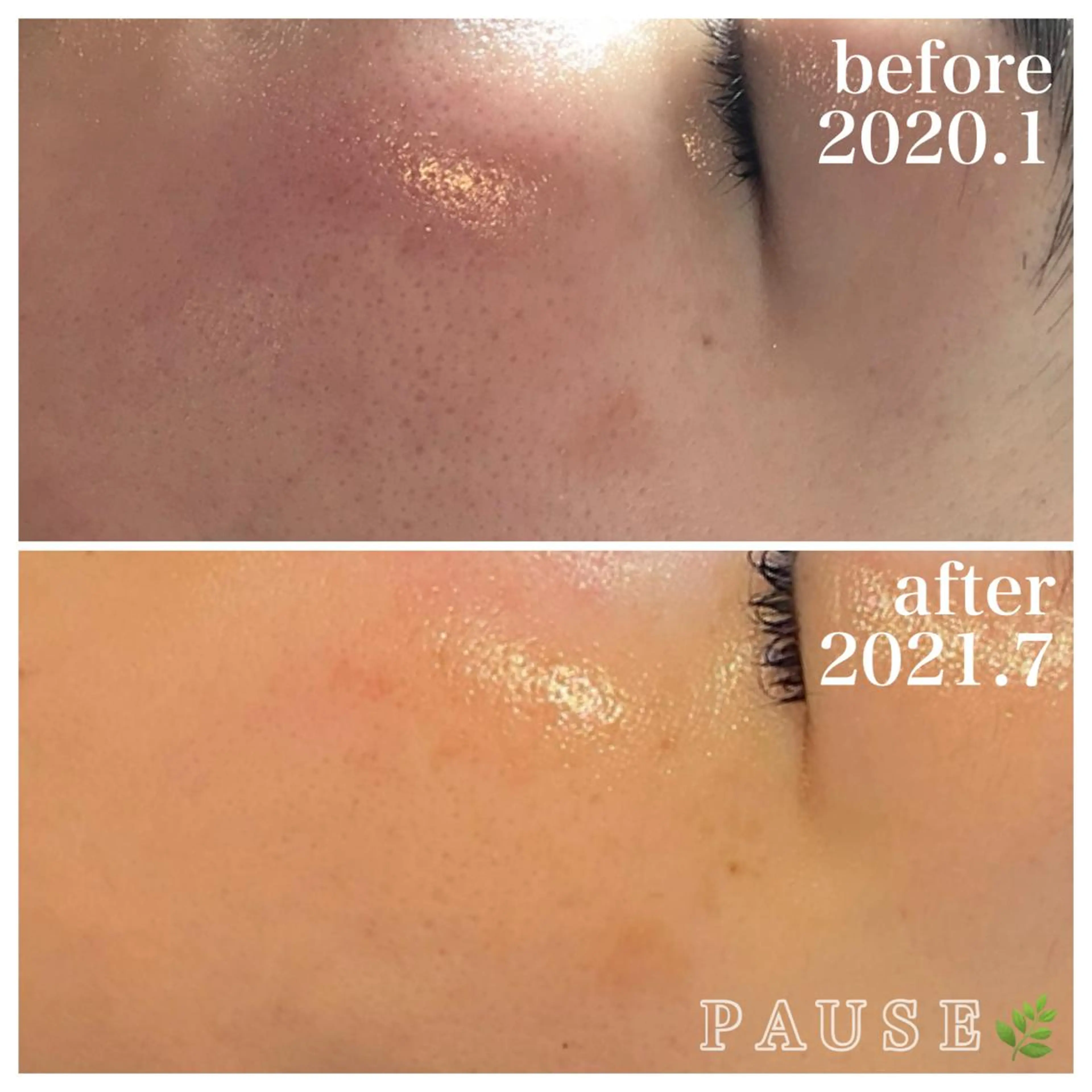 エステ 浜野 恵美のエステ・リラクイメージ