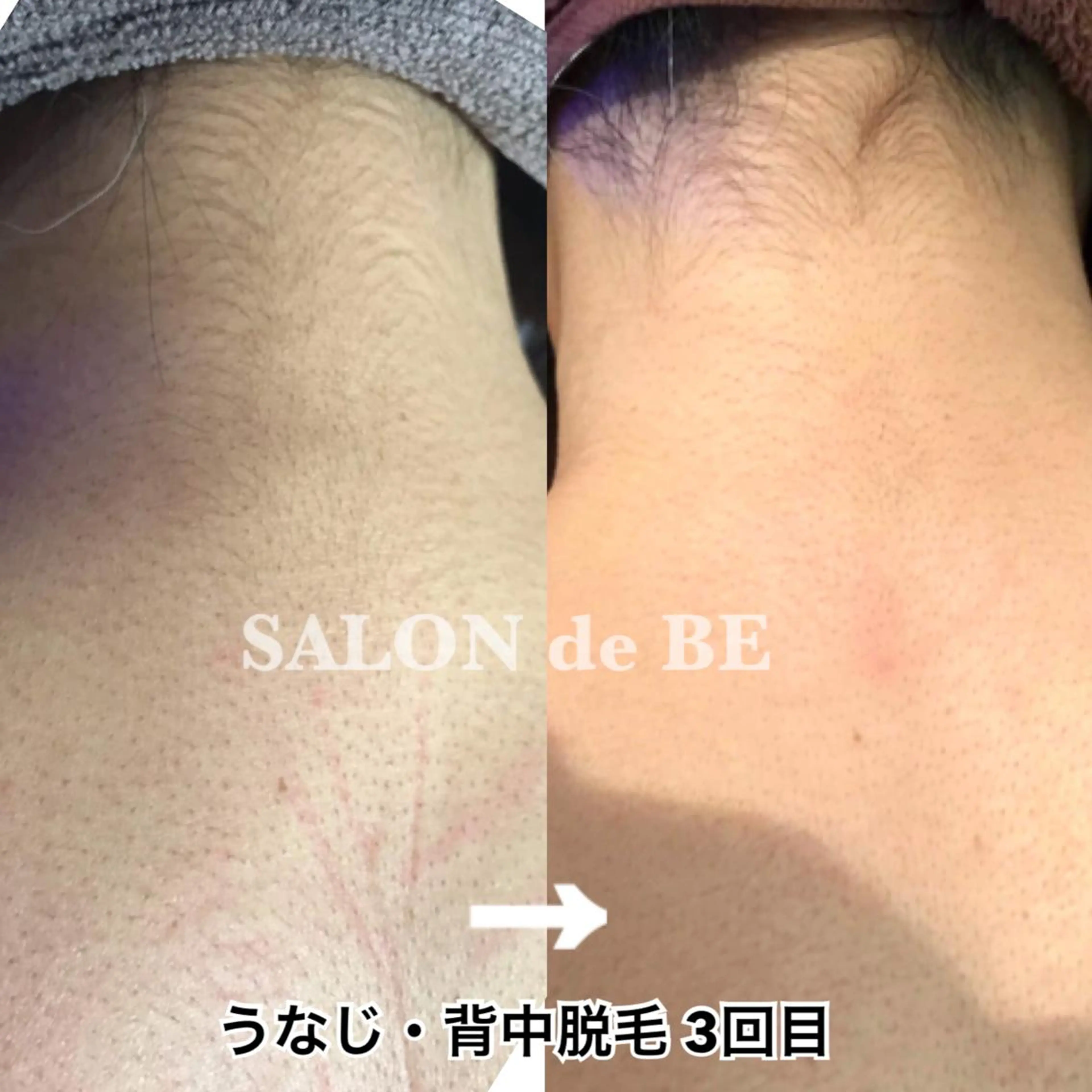 脱毛 Salon de Beのエステ・リラクイメージ