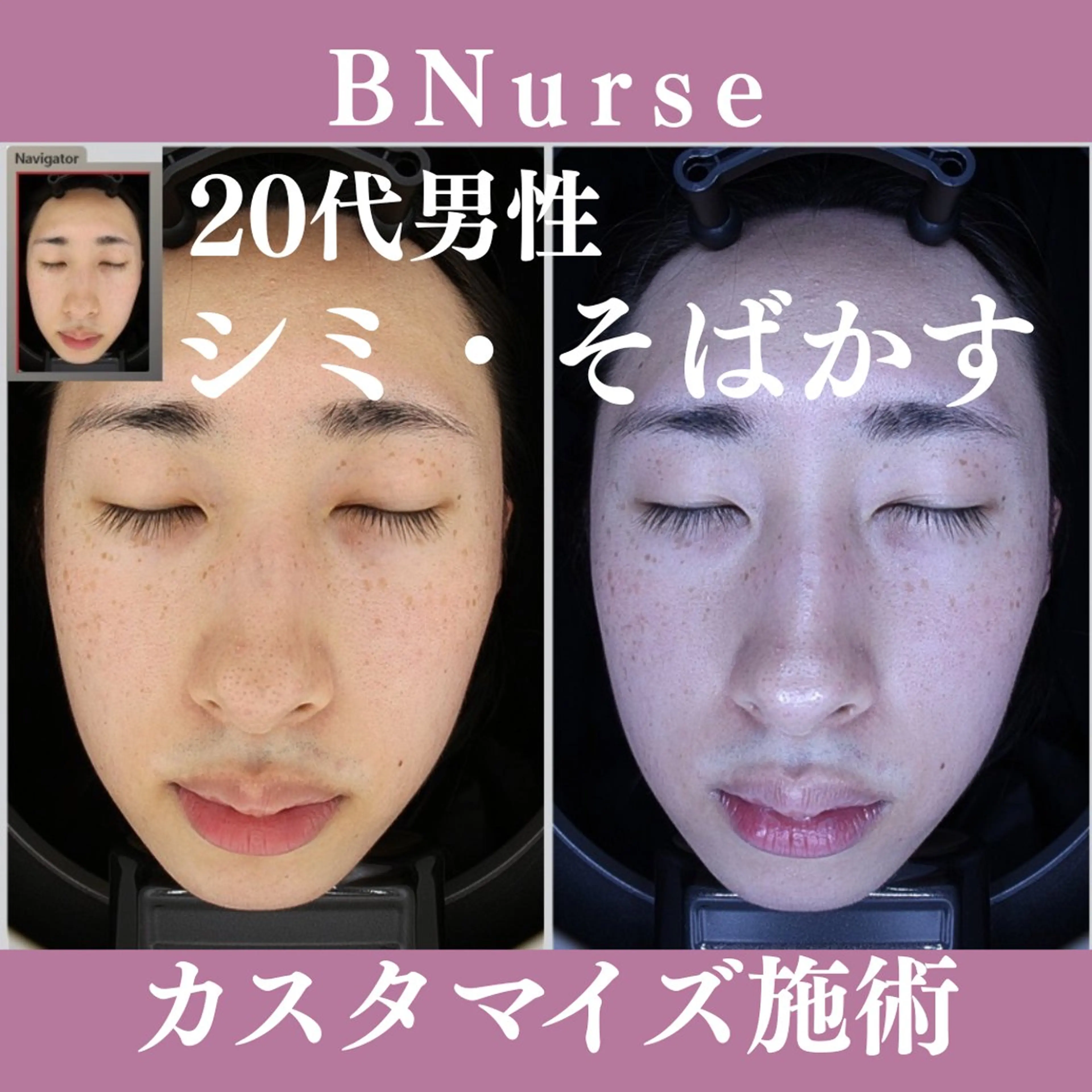 メンズ 美容看護師専属担当制 医学に基づく肌管理のエステ・リラクイメージ