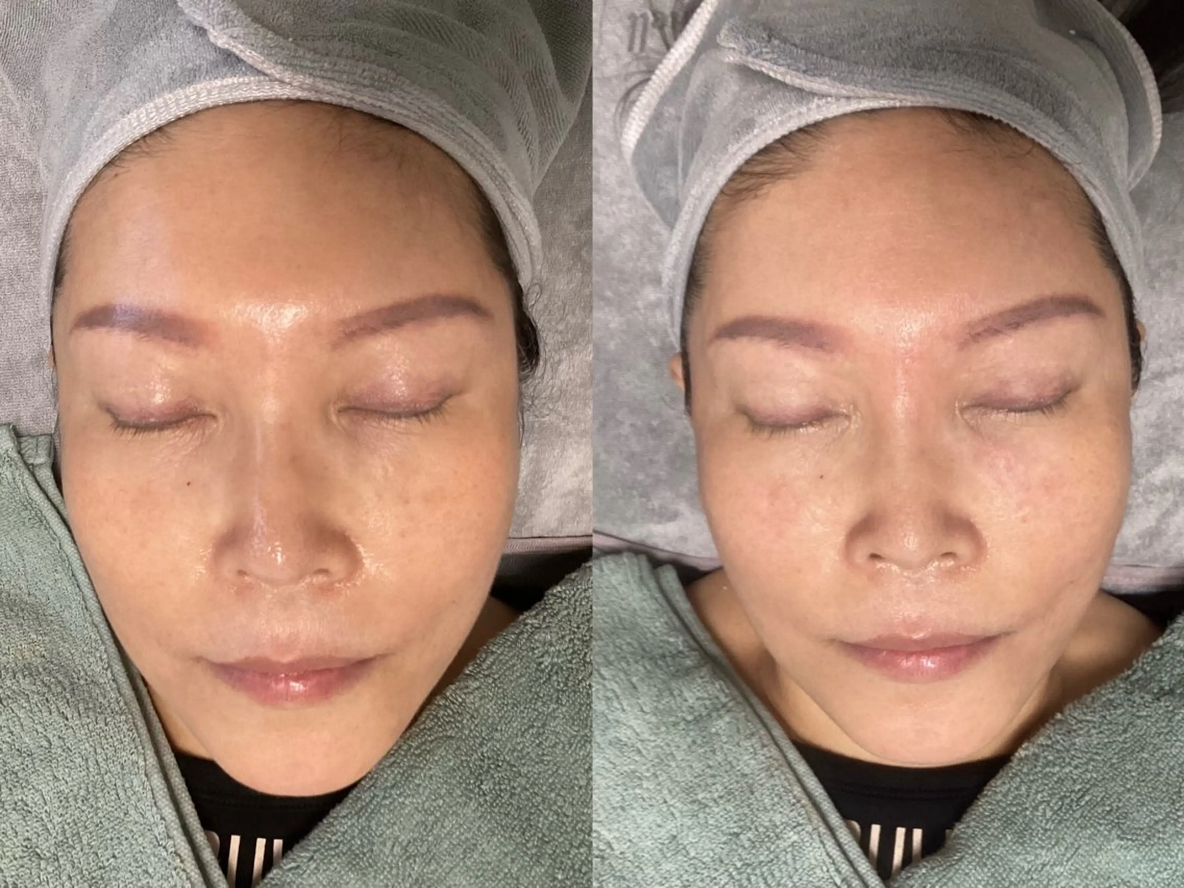 エステ リラク ホワイティアビシェル ウラワ　白澤奇のエステ・リラクイメージ