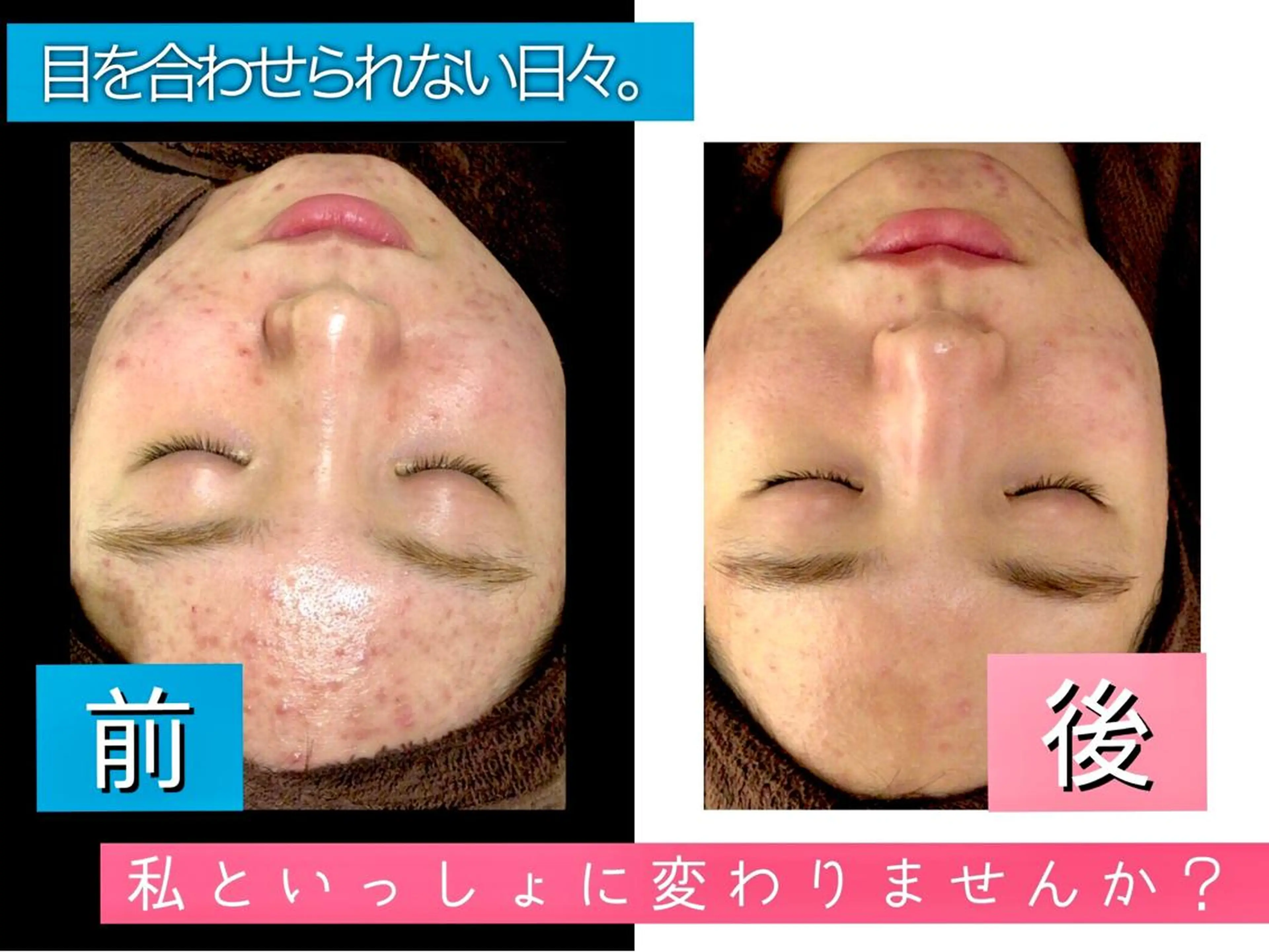 セミロング カラー パーマ ヘアアレンジ メンズ キッズ ネイル マツエク・マツパ 金の糸脱毛 産毛ケア専門のエステ・リラクイメージ
