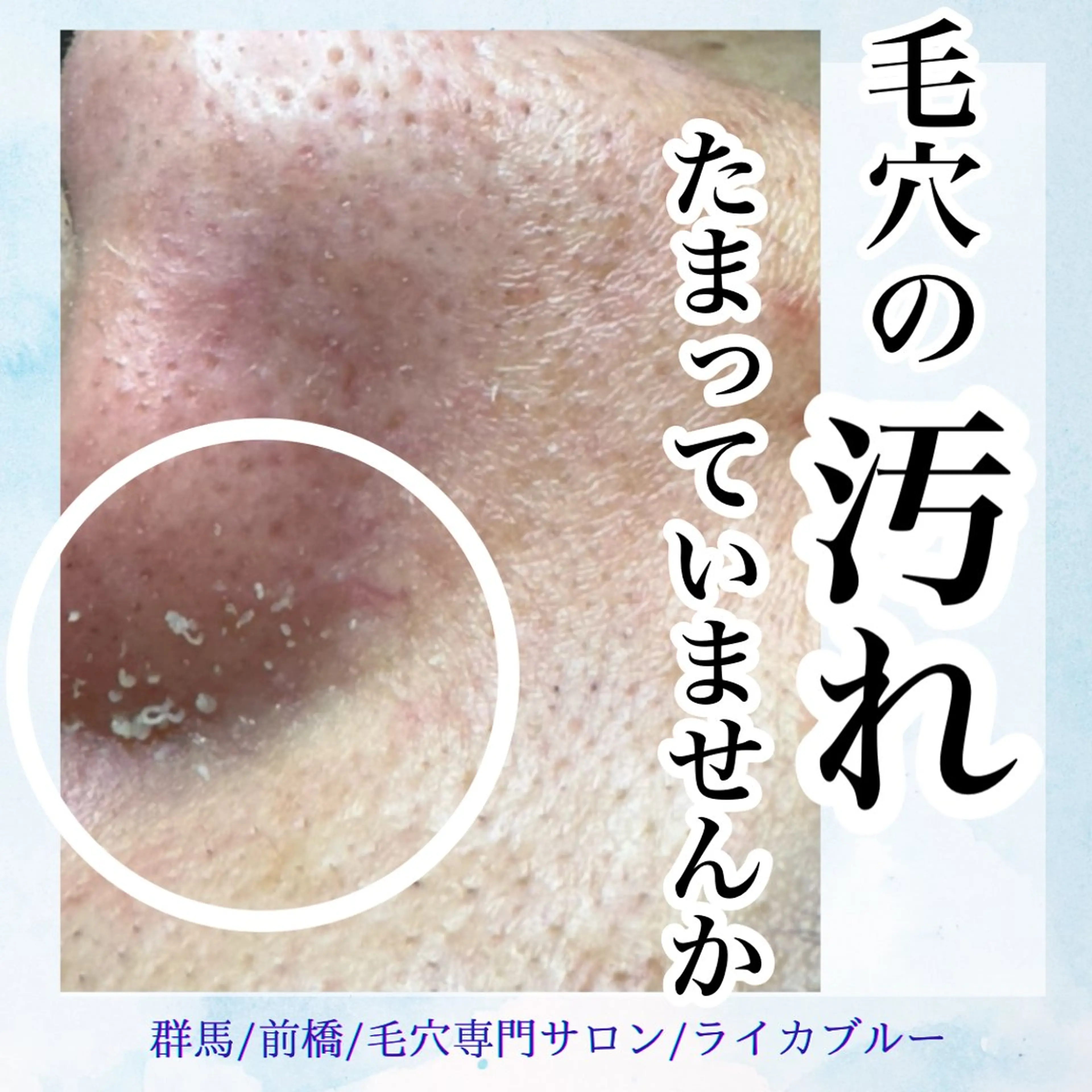 毛穴専門サロン ライカブルーのエステ・リラクイメージ
