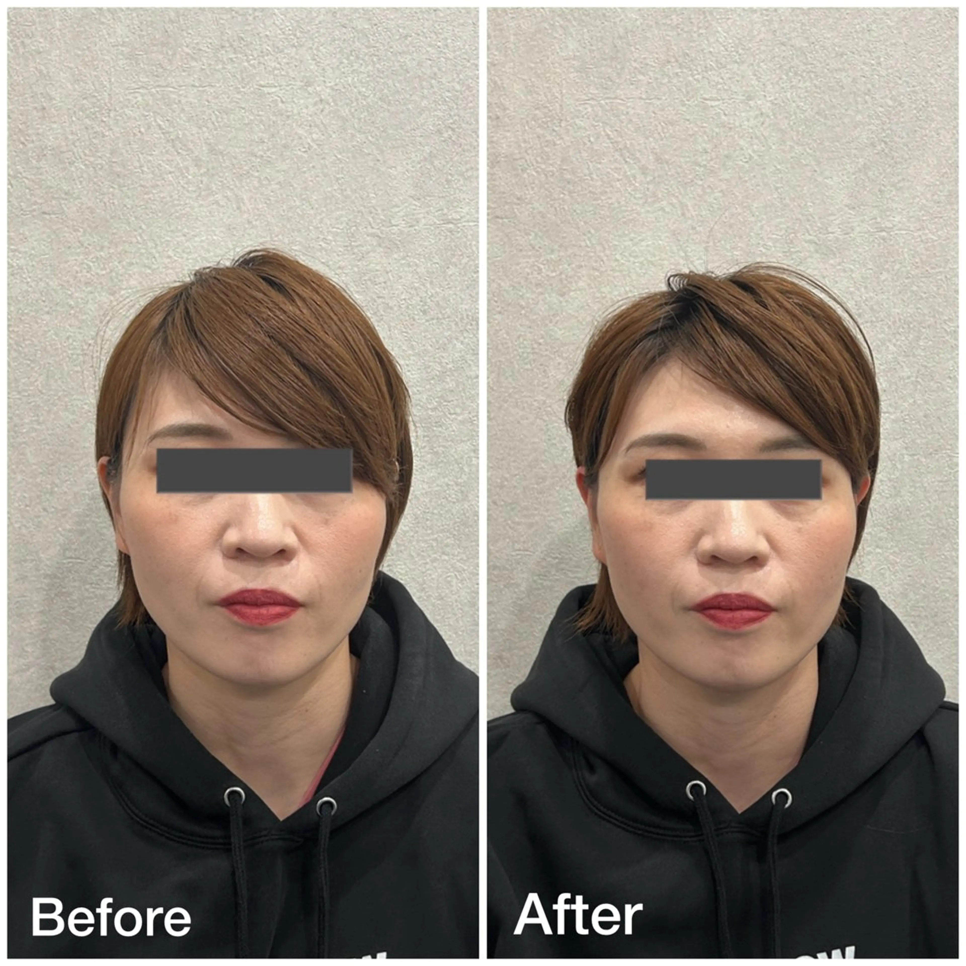 小顔矯正・骨盤矯正 FLOW鍼灸整体院のエステ・リラクイメージ