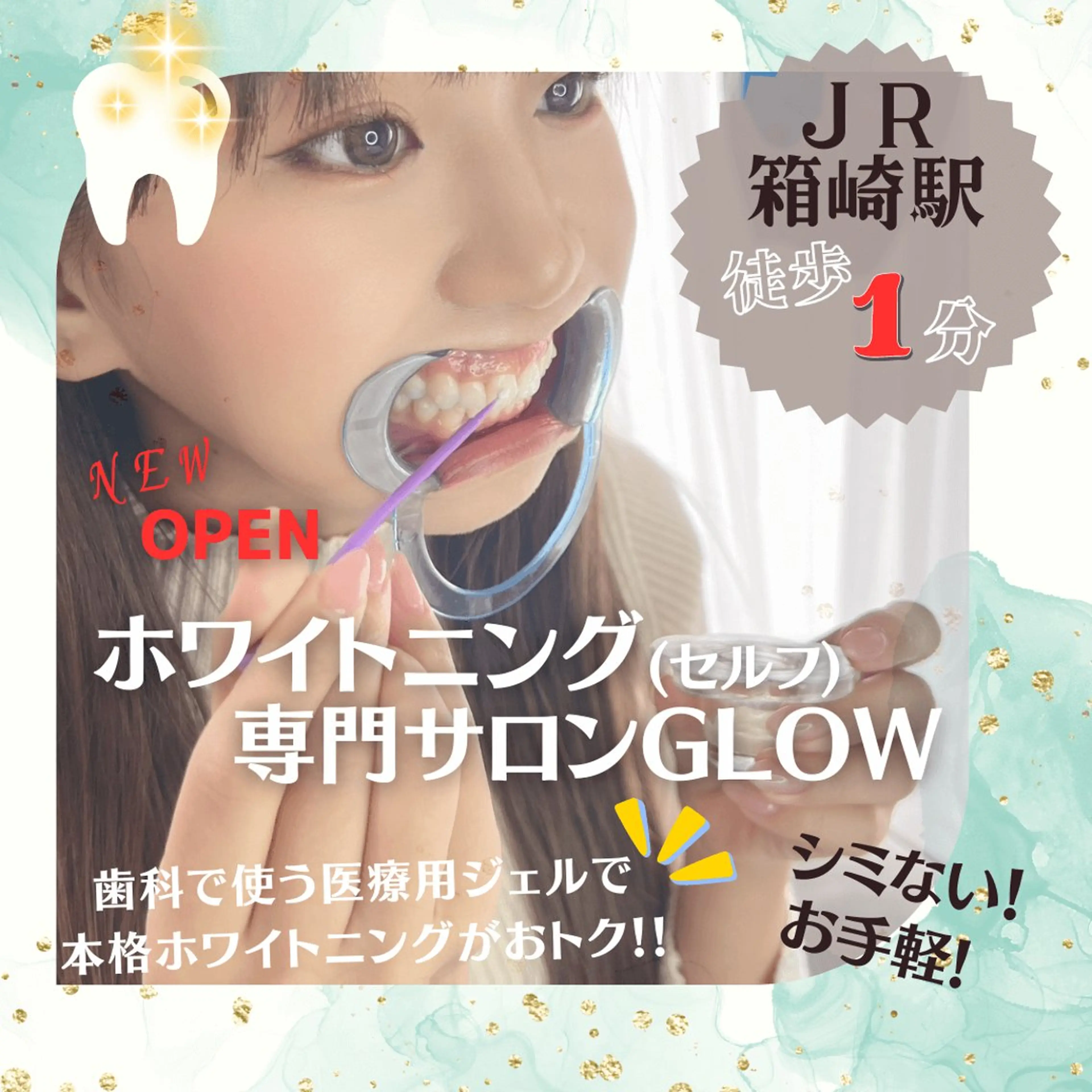 歯のセルフホワイトニング専門店GLOW（グロウ）所属・東区香椎歯のセルフホ ワイトニングGLOWのその他イメージ