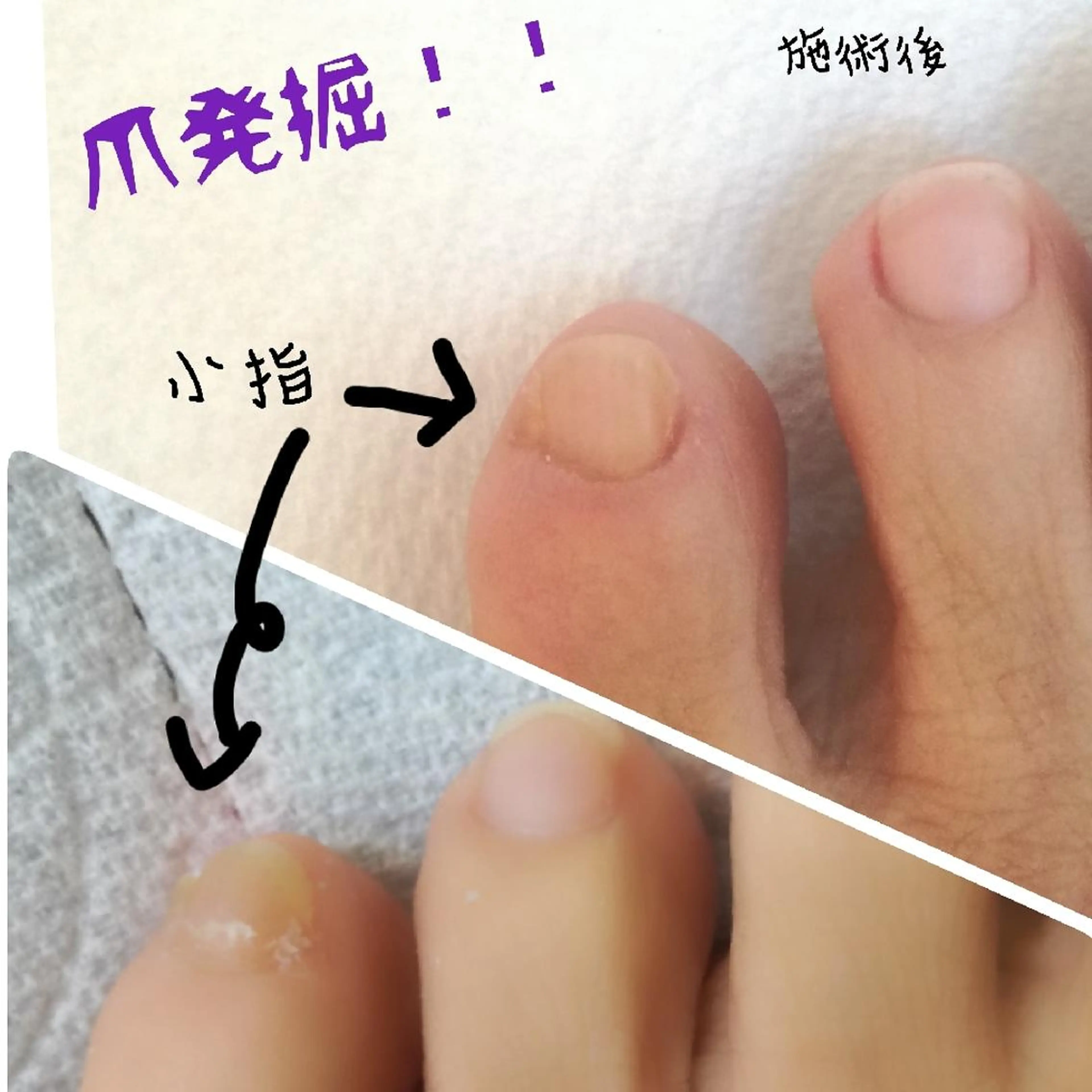 ネイル コエリネイル &エステのネイルデザイン