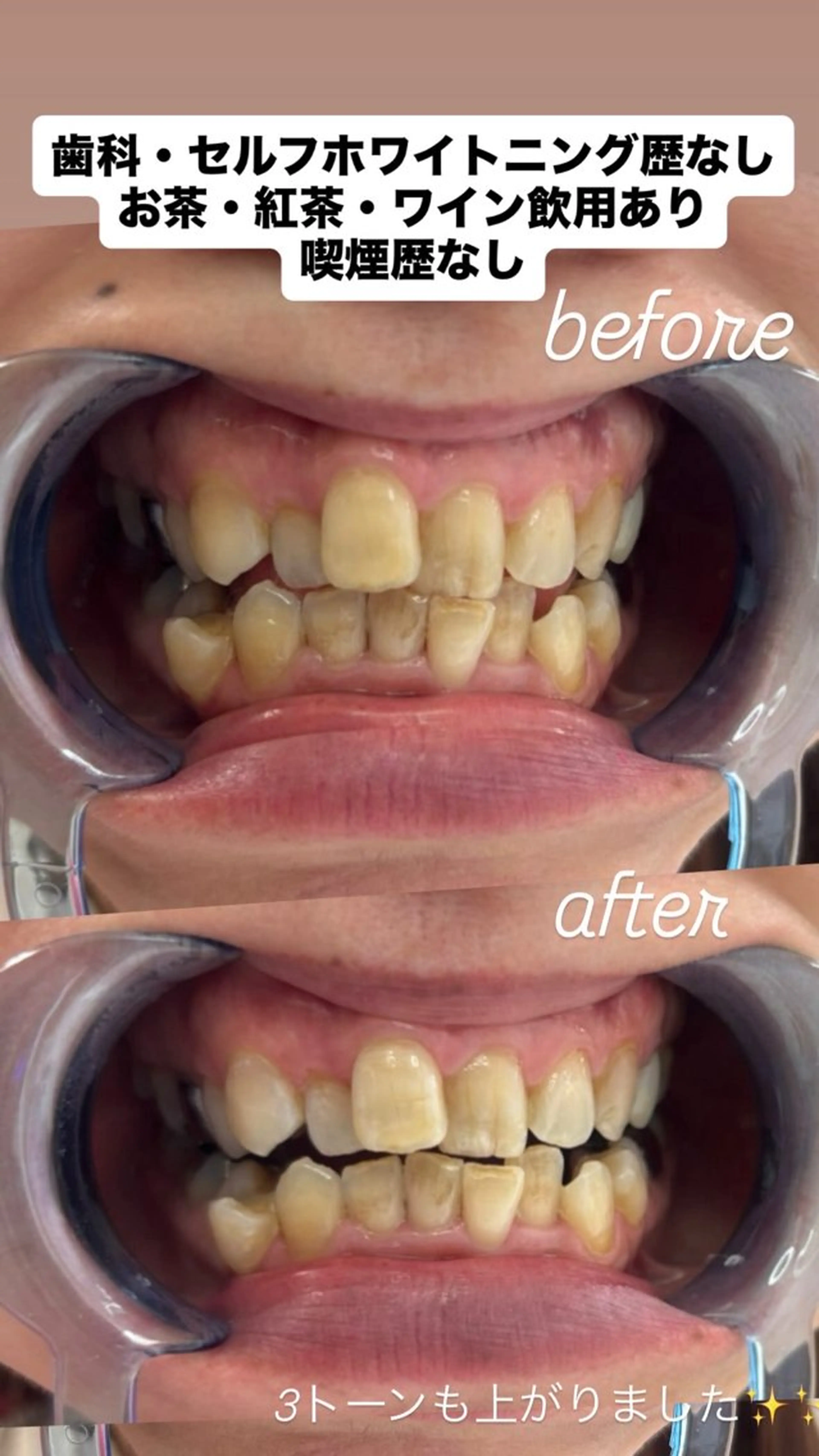 その他 Fullcover beautyのその他イメージ