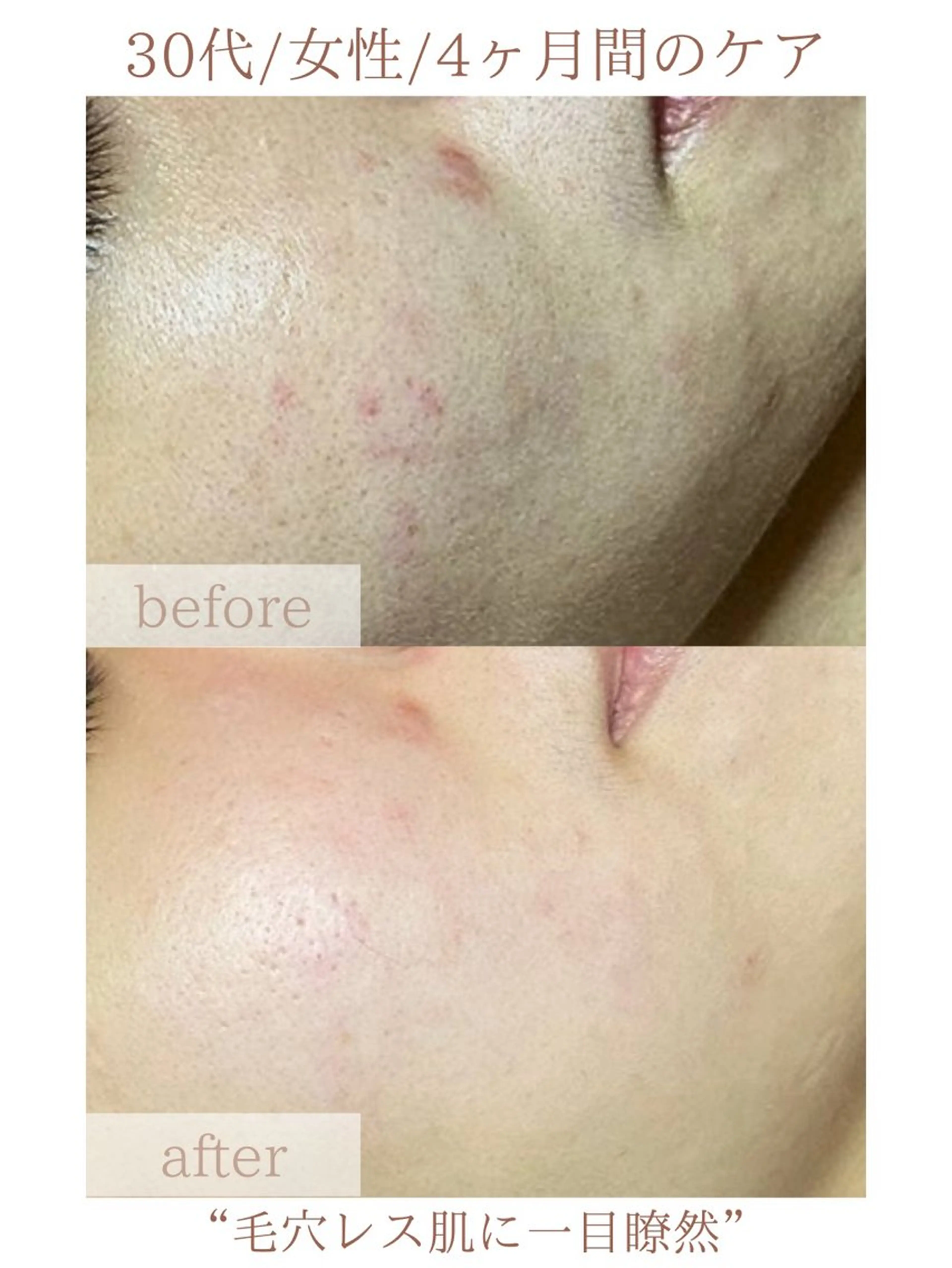 エステ 毛穴改善サロン d'Alba大阪住吉のエステ・リラクイメージ