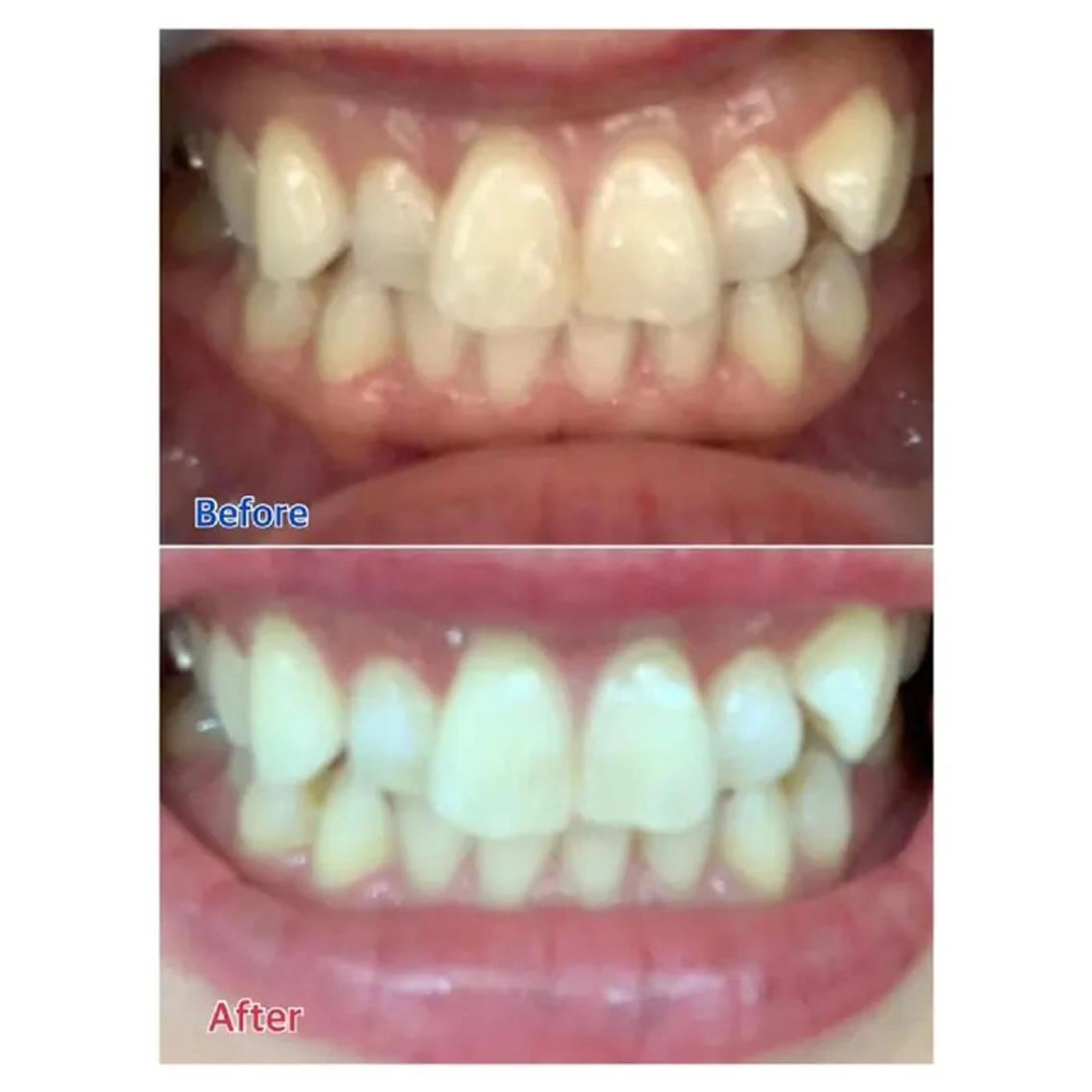 M渋谷 ホワイトニングのその他イメージ