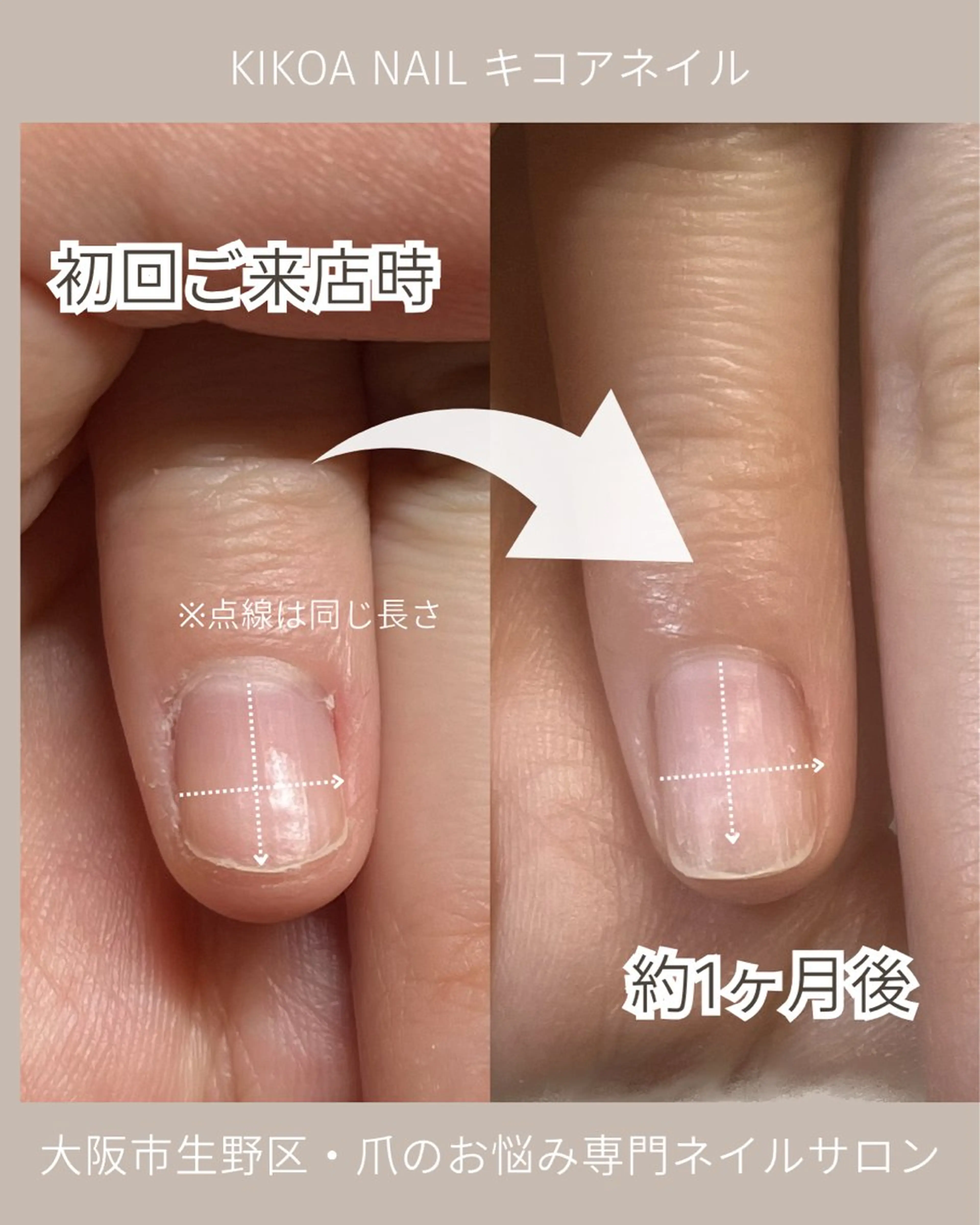 ネイル メンズネイル KIKOA NAIL キコアネイルのネイルデザイン