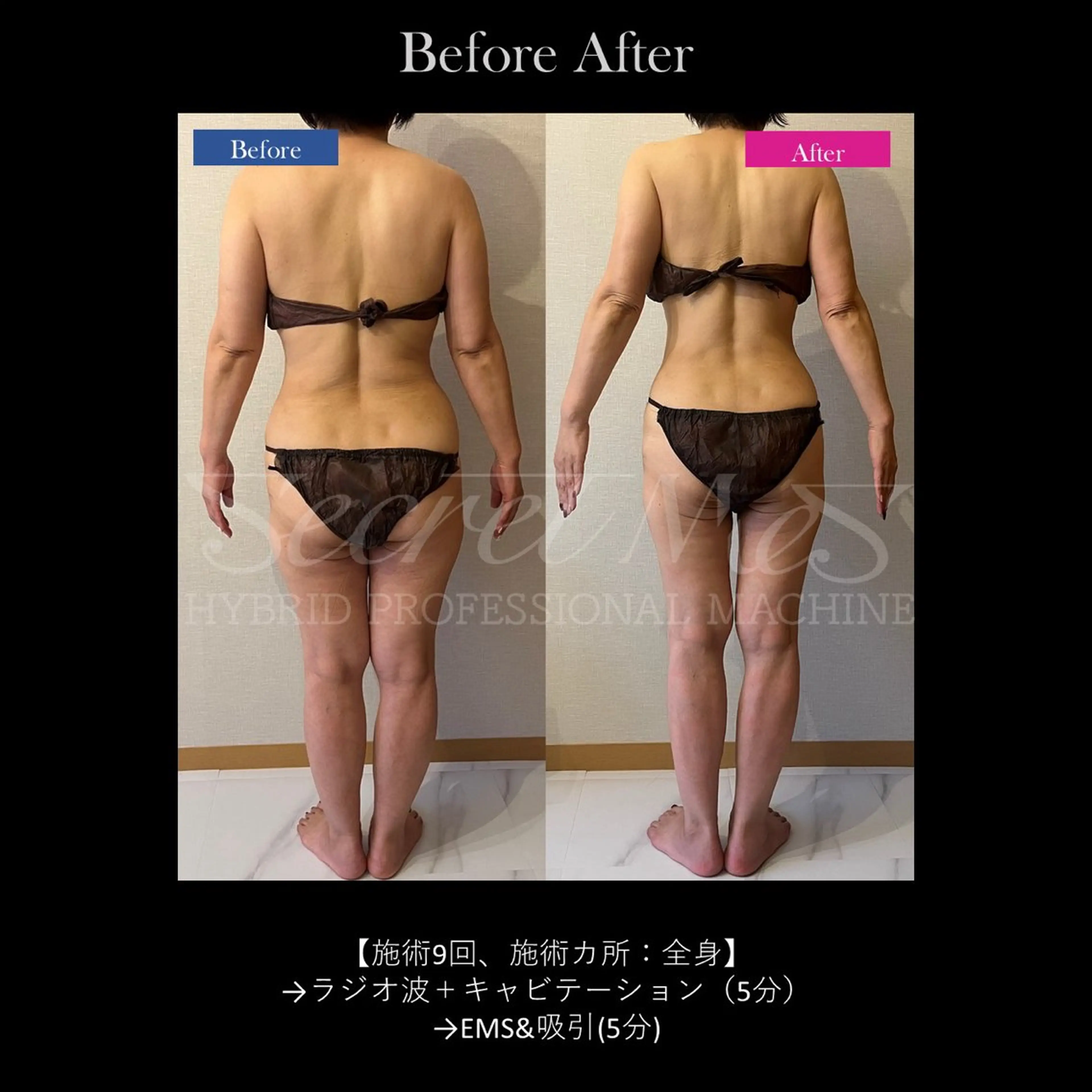 Bellvie beauty salon所属・Bellvie かすみのエステ・リラクイメージ