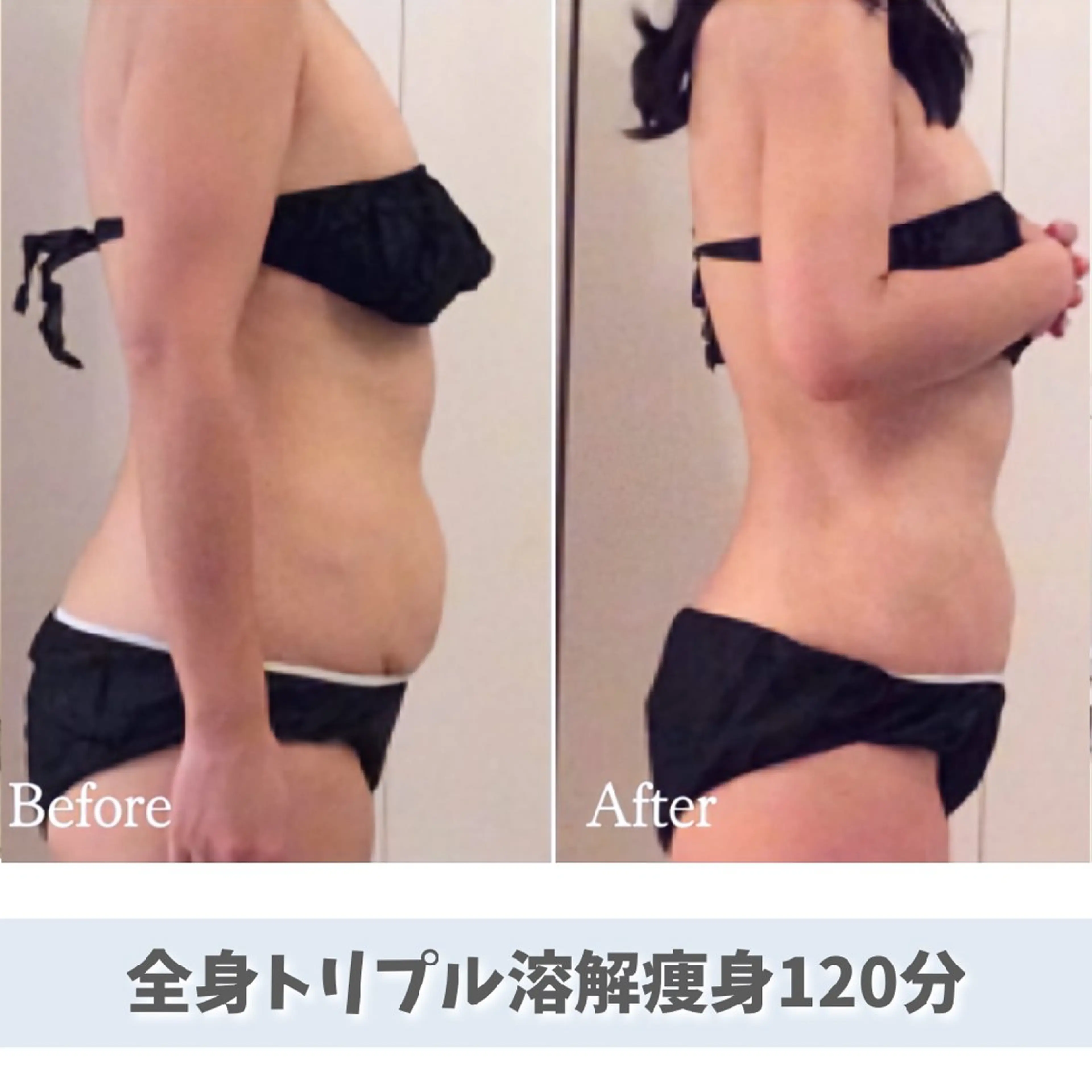 【ご新規様限定25%OFF】全身しっかりダイエット✨トリプル溶解痩身120分の写真