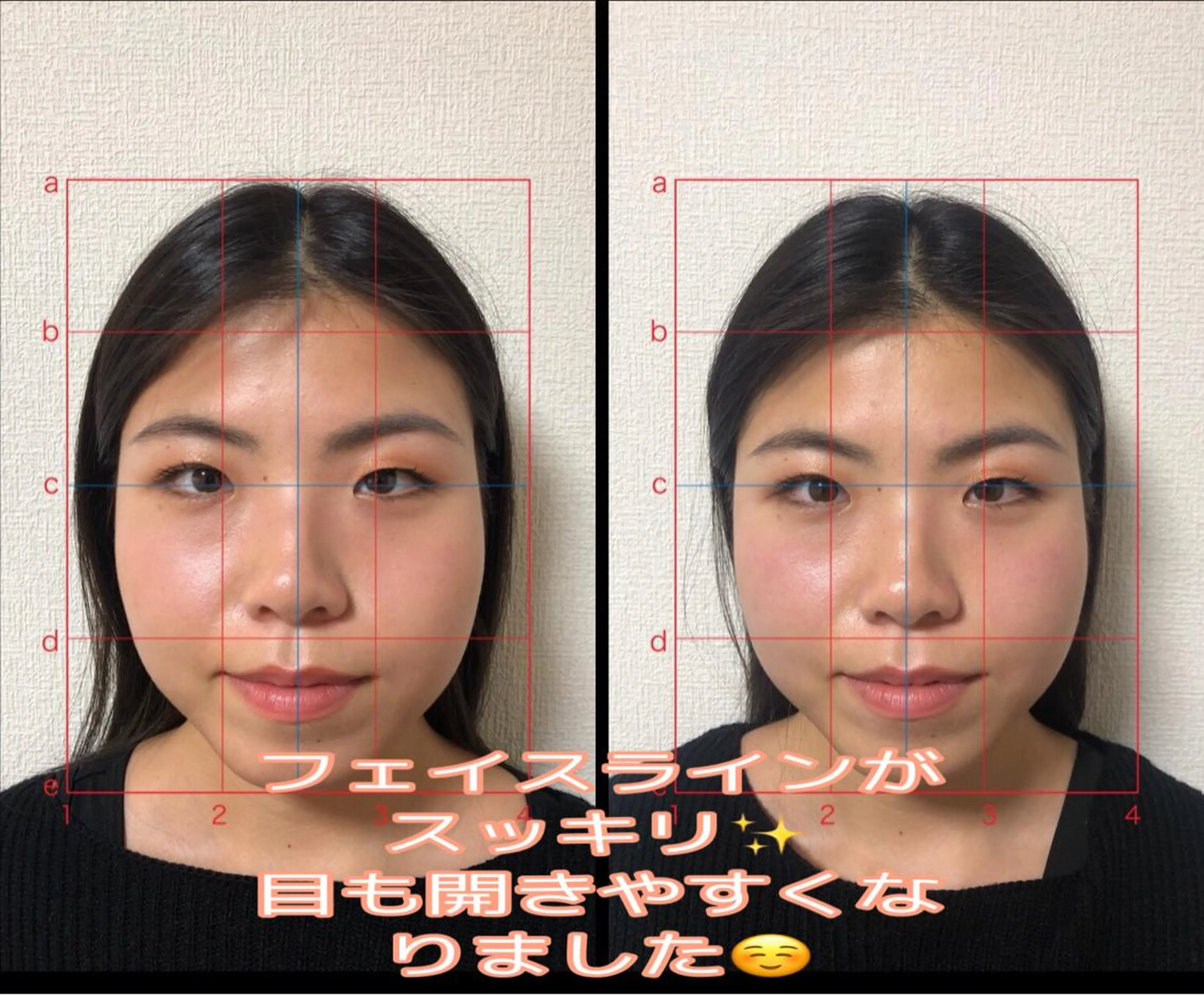 やはた 鍼灸整骨院のエステ・リラクイメージ