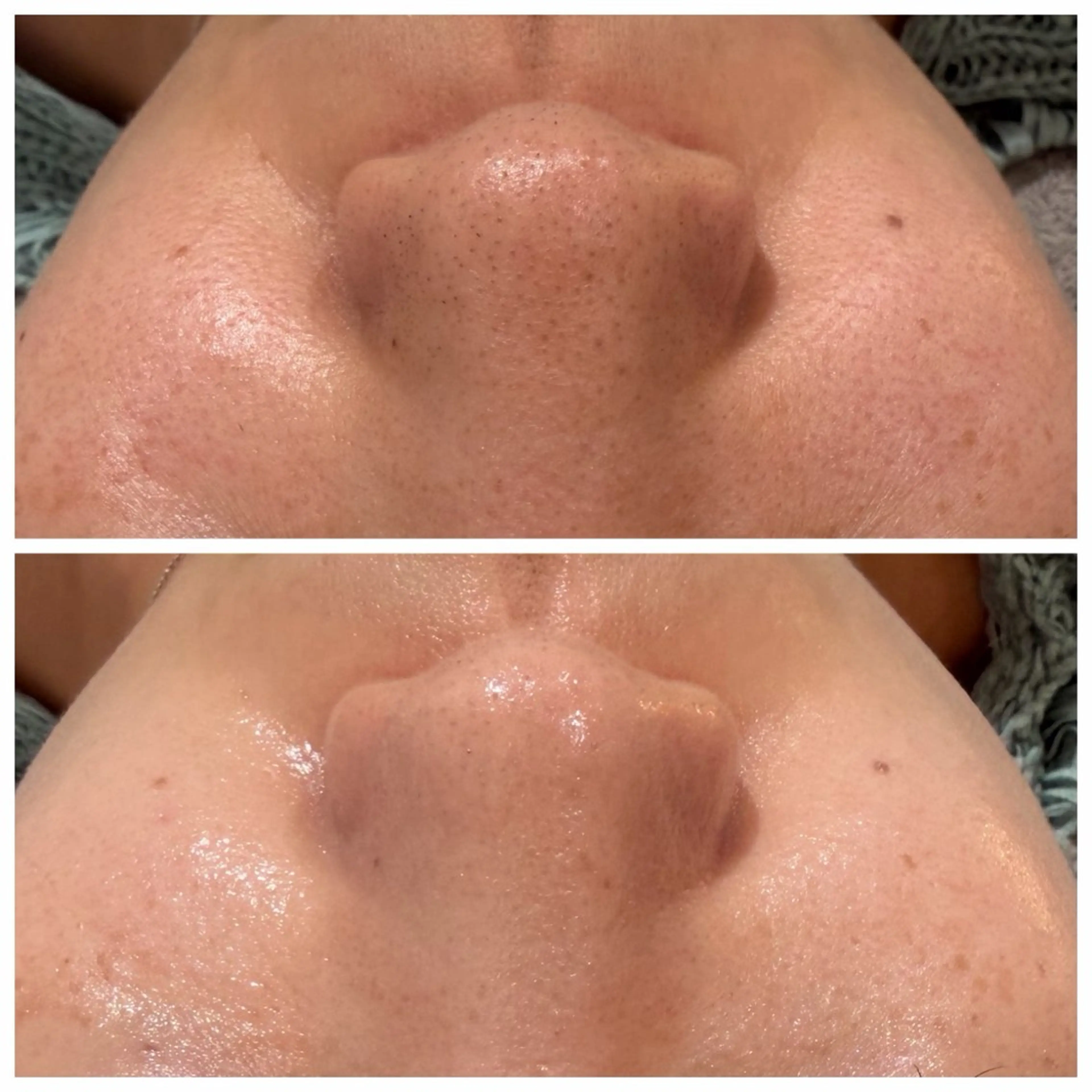 その他 Raviy 【痩身・韓国肌管理】のエステ・リラクイメージ