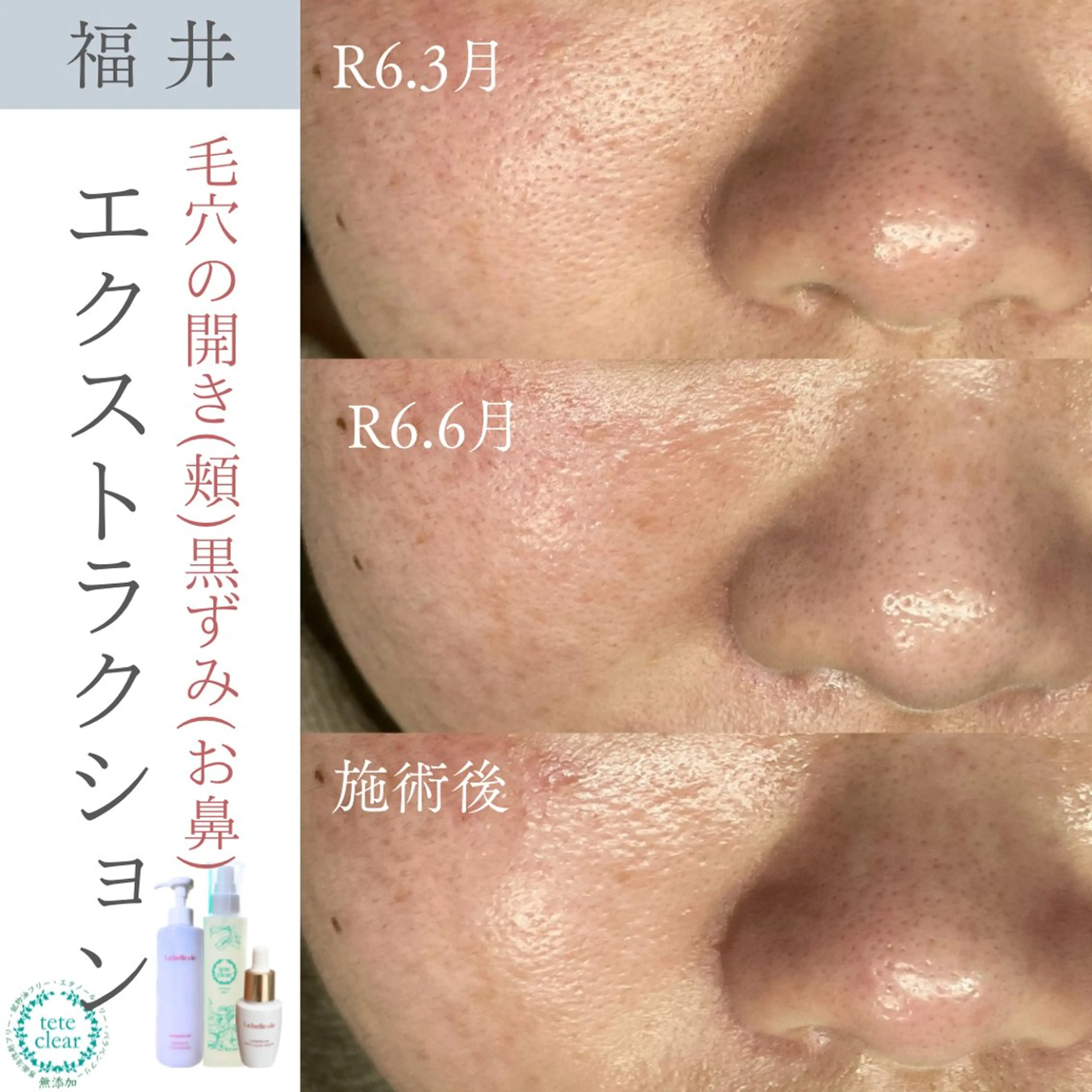 毛穴肌質ケアサロン Yourmeユアミーのエステ・リラクイメージ