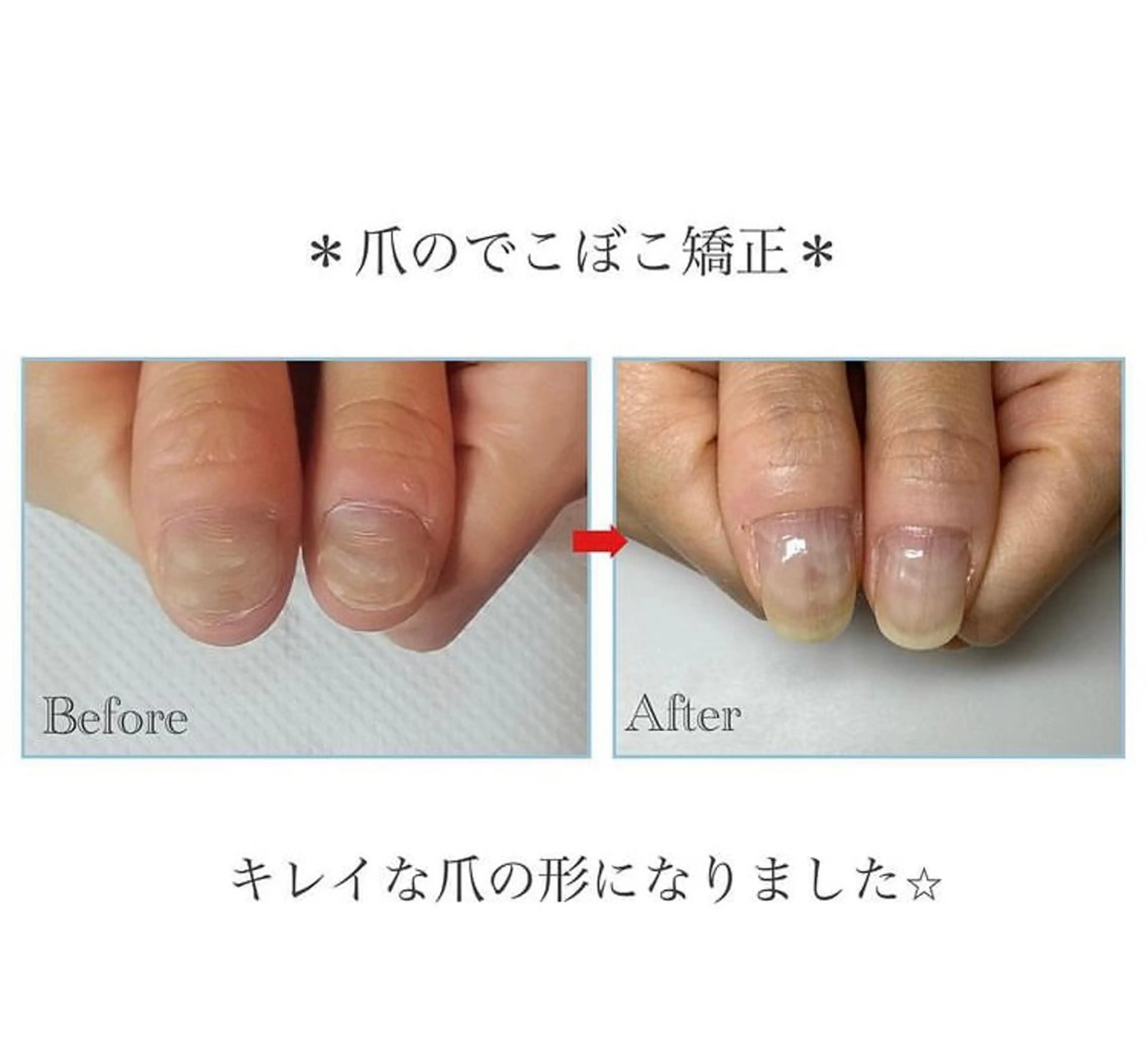 ネイル ネイルサロンアリューム所属・ネイルサロン アリュームのネイルデザイン