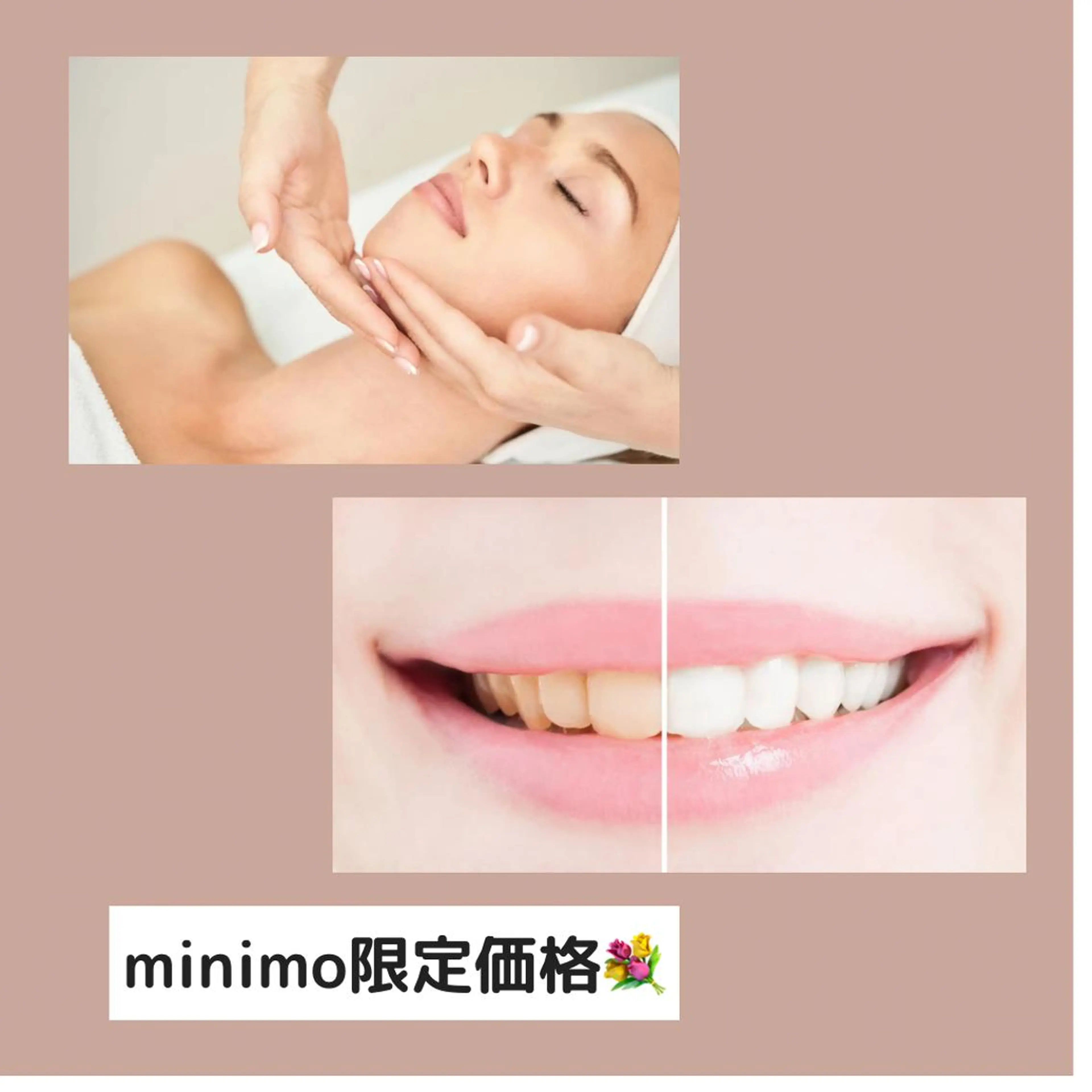 計4照射🦷ハイパワーセルフホワイトニング+9分照射×2回 2セットの写真