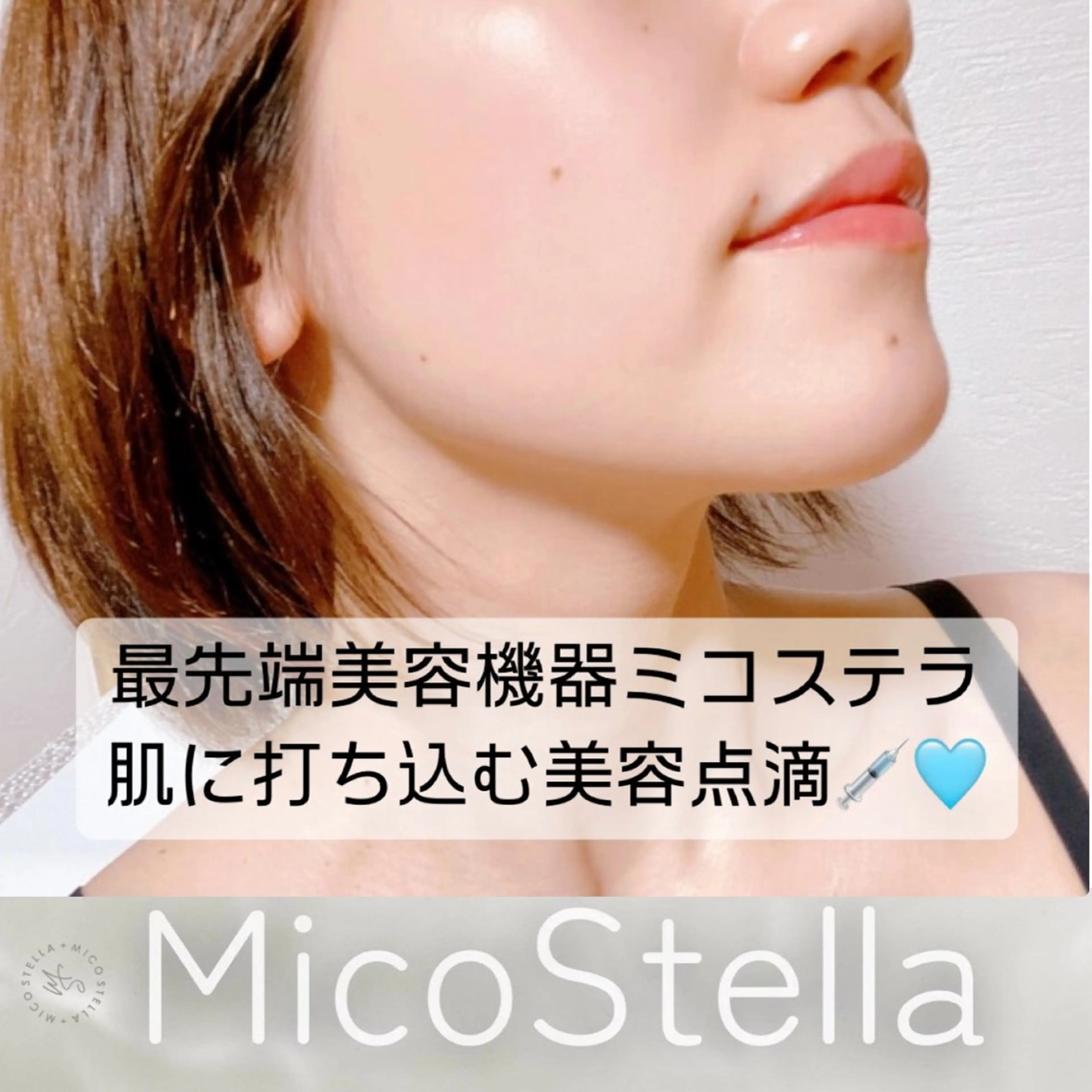 【ツヤ・乾燥肌に】高濃度酸素注入＋セラミド注入でしっとりお肌に🫧の写真