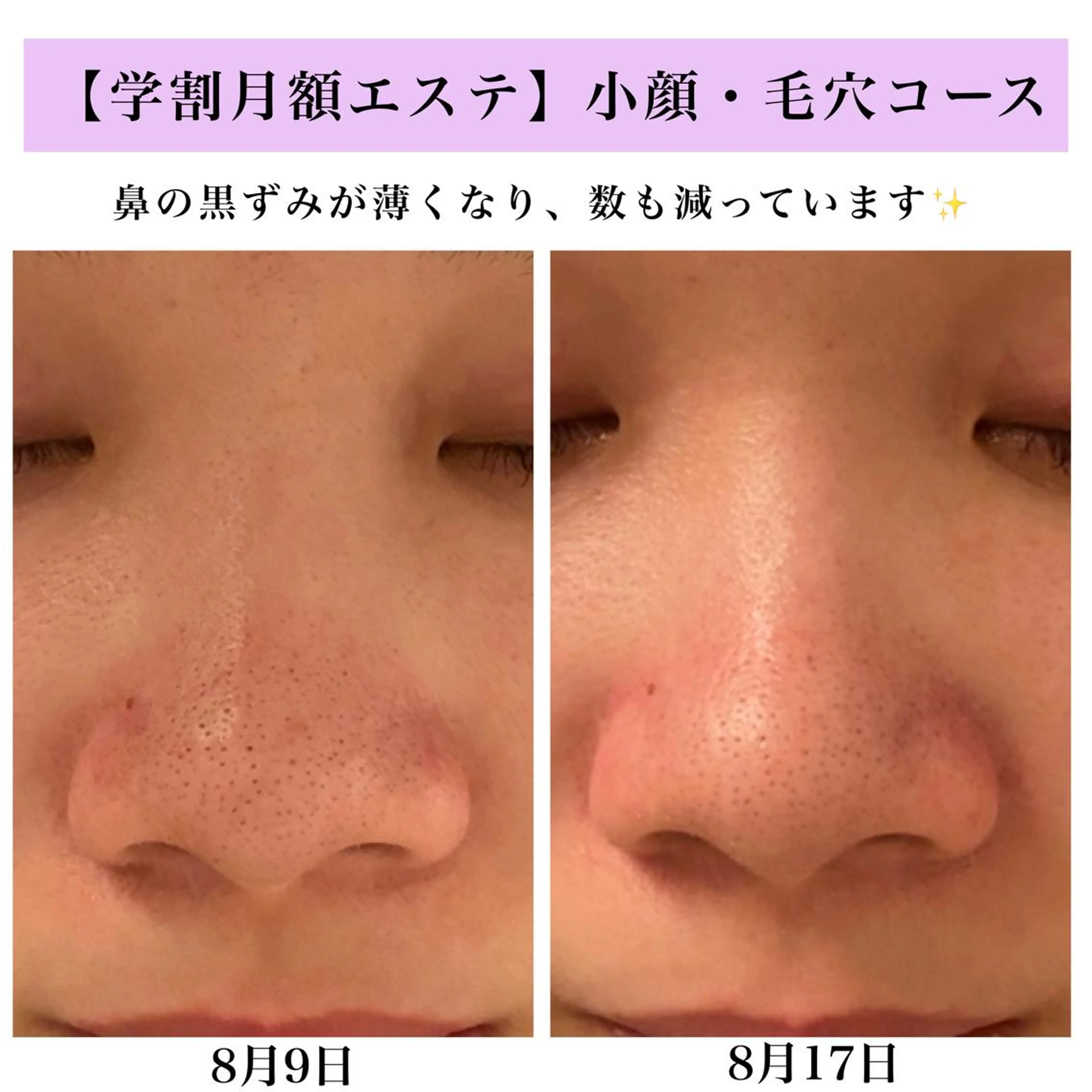 Bellesthe （ベルエステ）のエステ・リラクイメージ