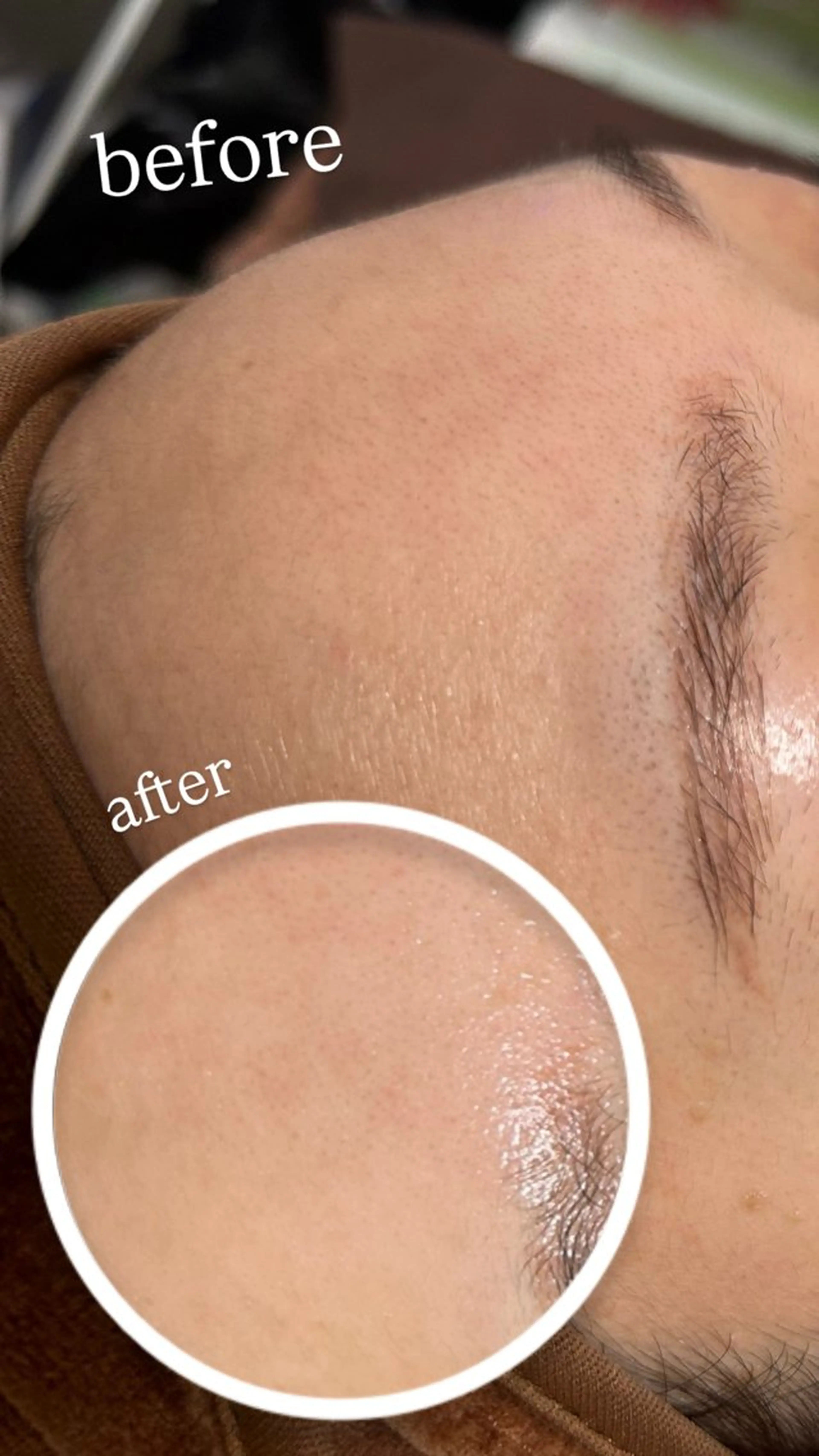 エステ 産毛角質ケア/艶肌 フェイシャルワックスのエステ・リラクイメージ