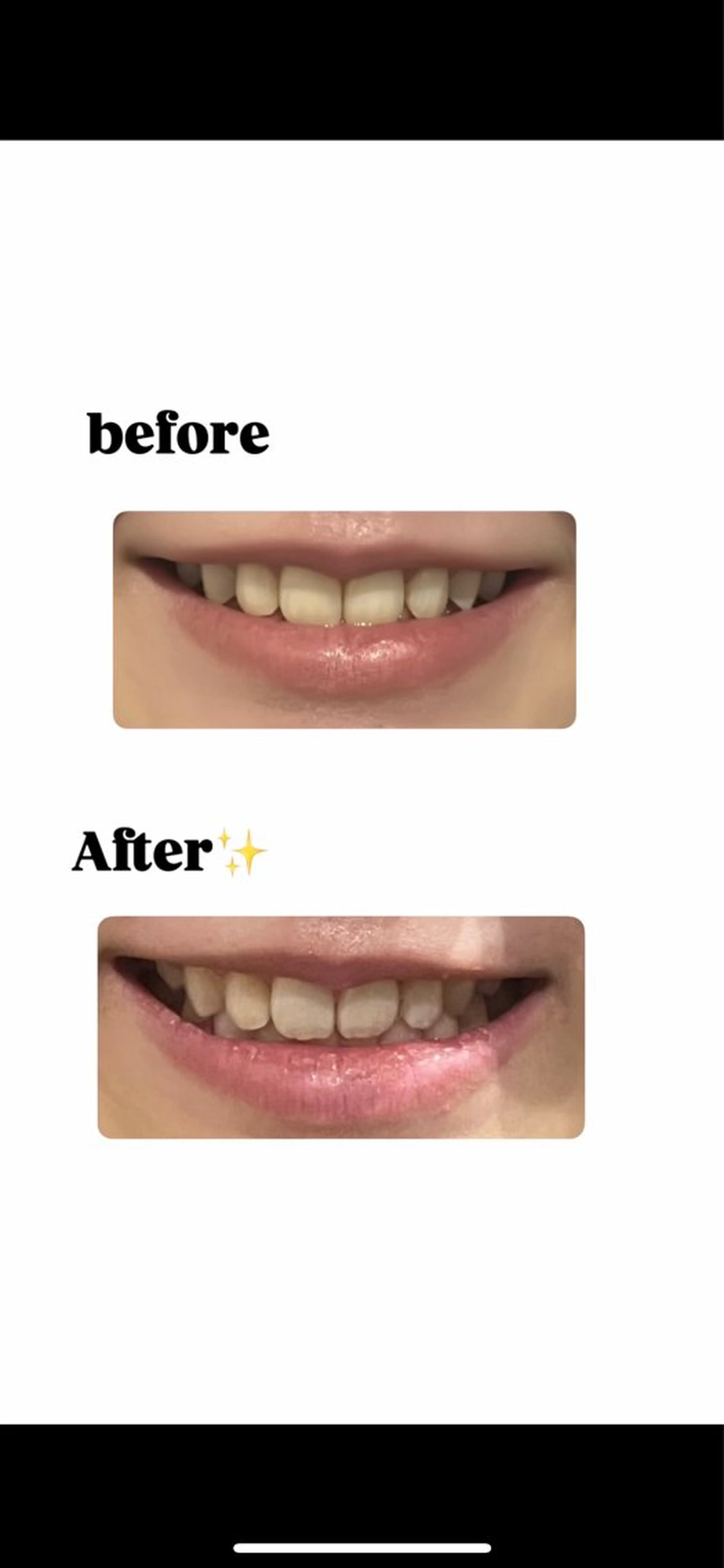 その他 トータルボディメイクヴェアリー所属・vary 佐々木のその他イメージ