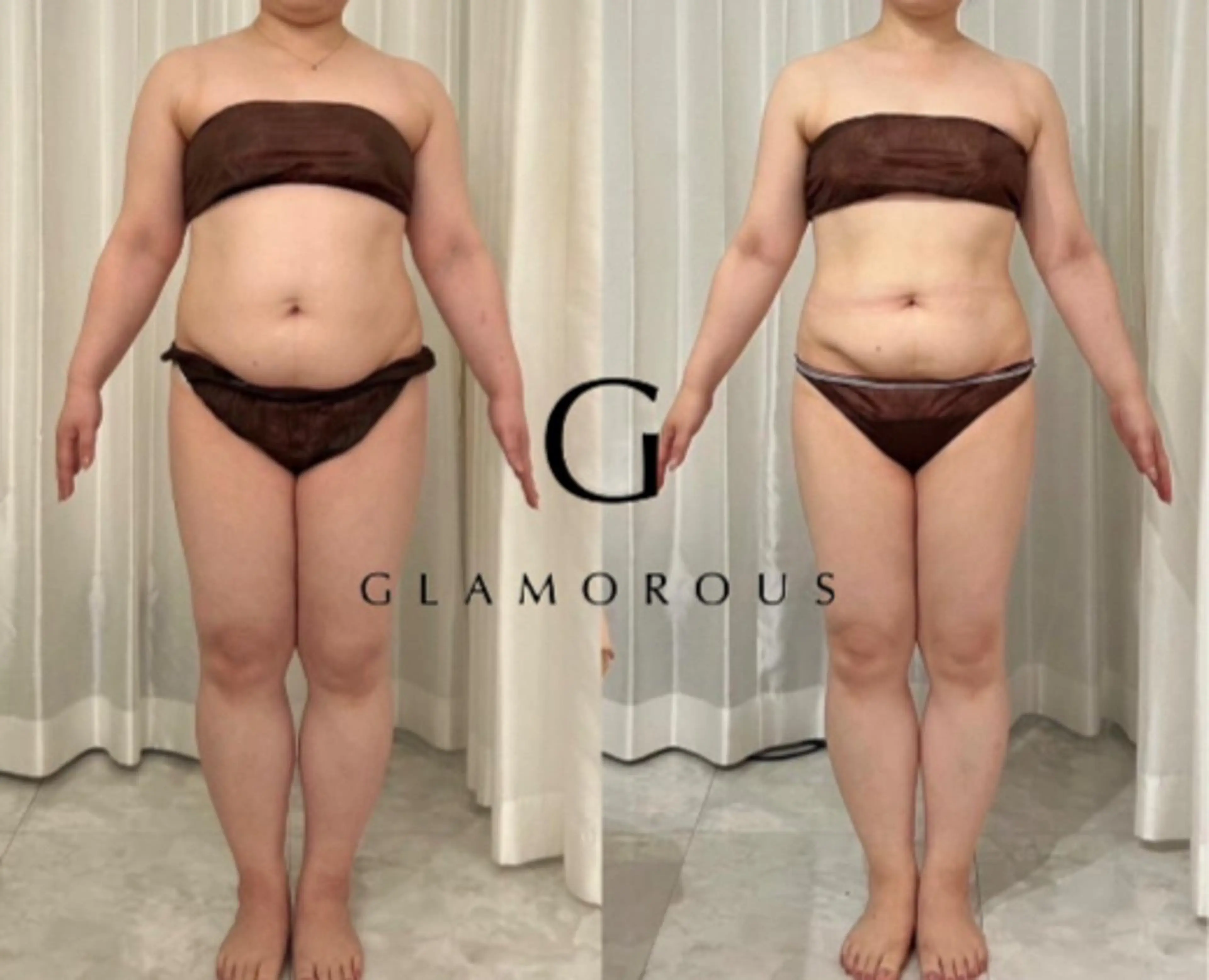 熊本｜何しても痩せない女性専用本気の体質改善ダイエット体験の写真