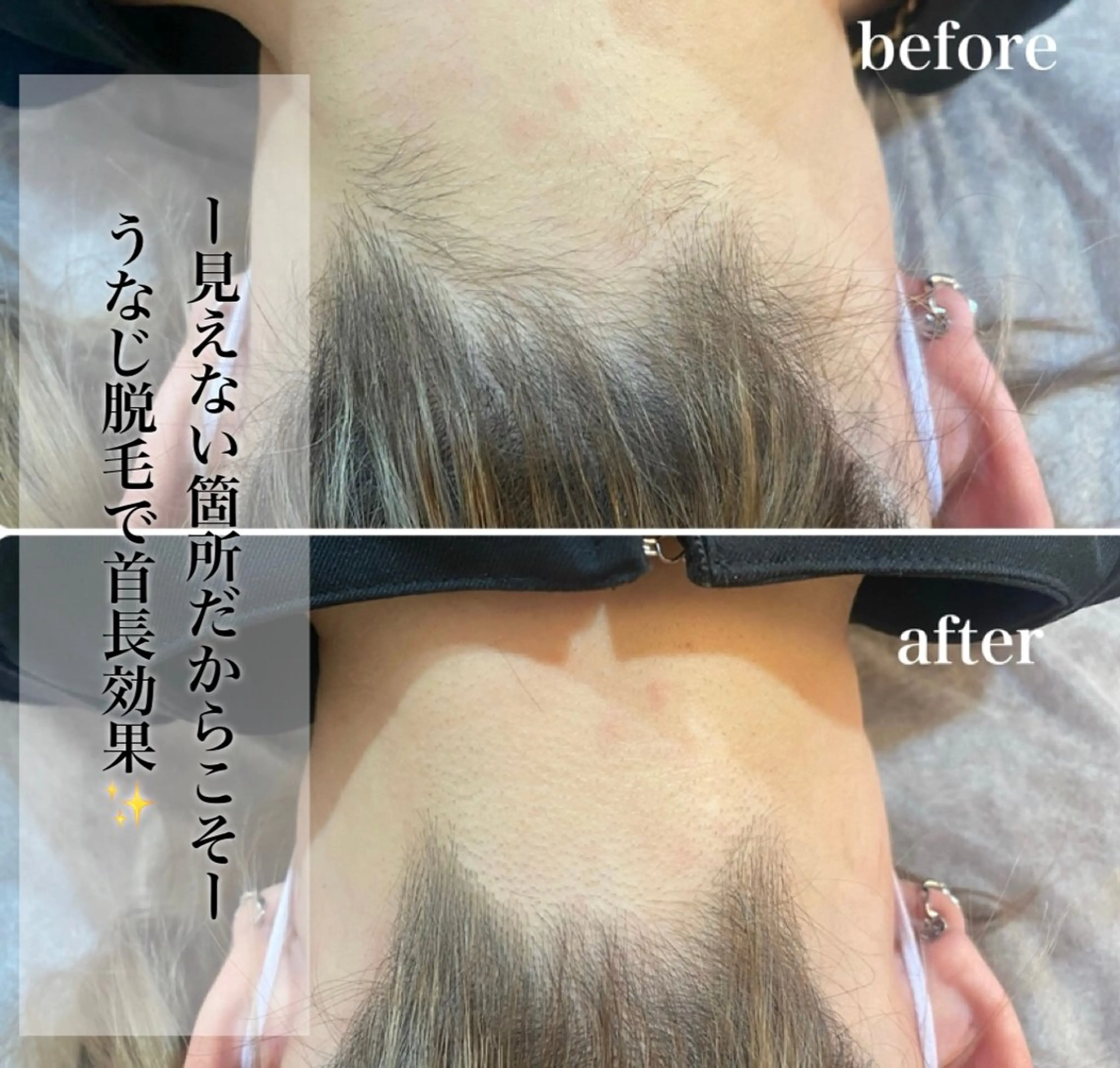 脱毛専門サロンElixir所属・脱毛専門サロン ELIXIR館林店のエステ・リラクイメージ