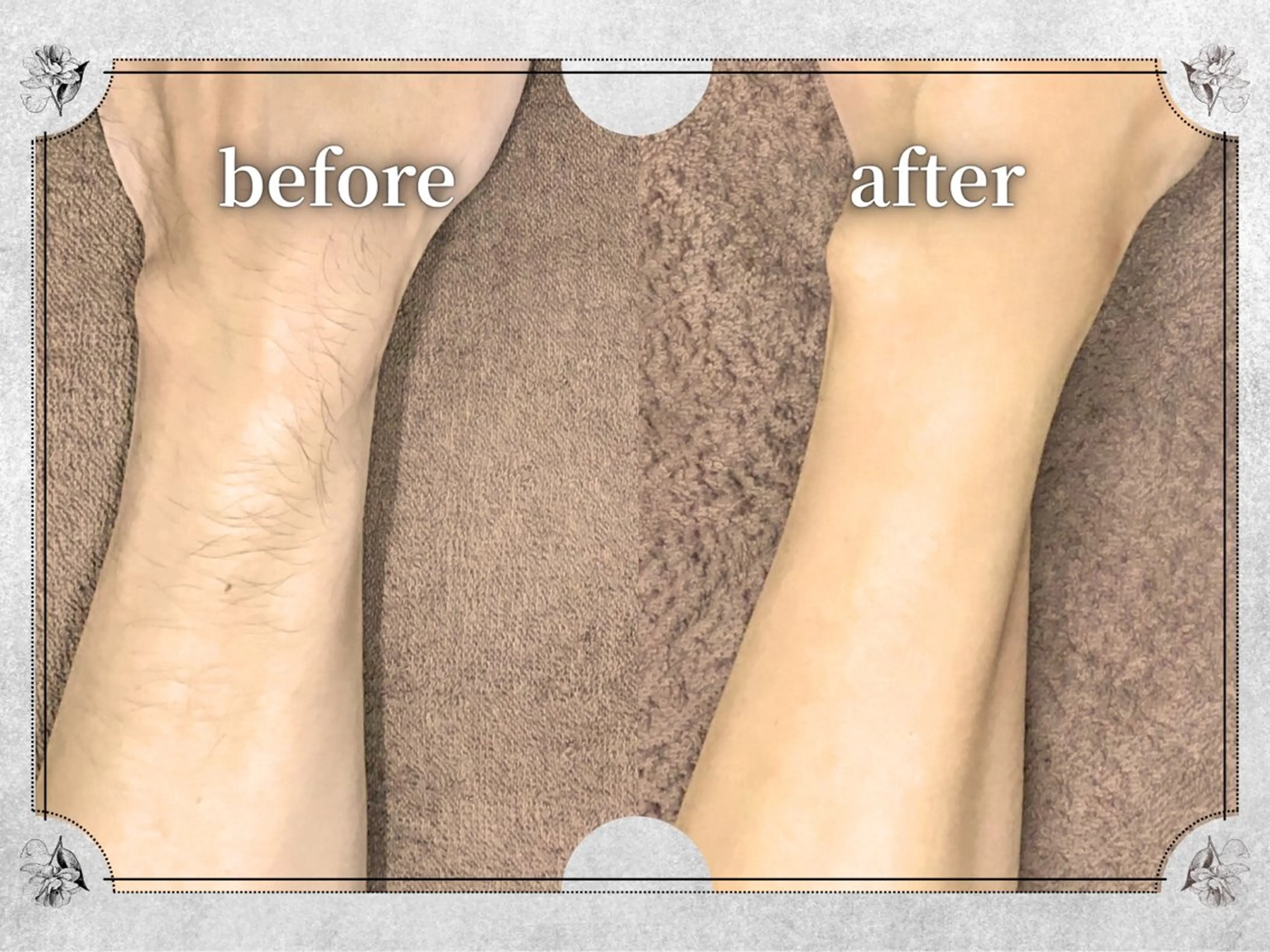 都度払い脱毛 Lino柏/Moneのエステ・リラクイメージ