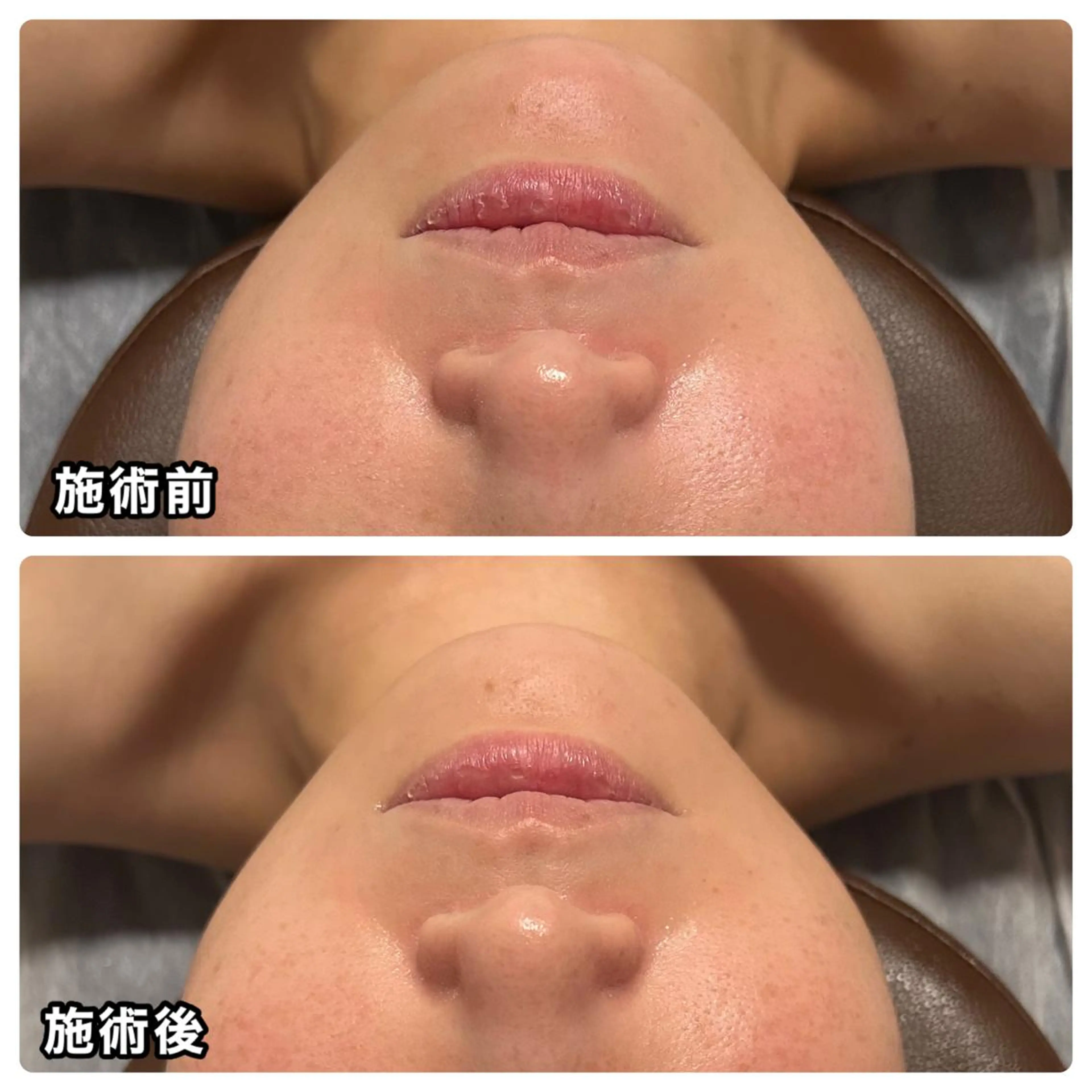 🌴Beauty Salon LANAのエステ・リラクイメージ