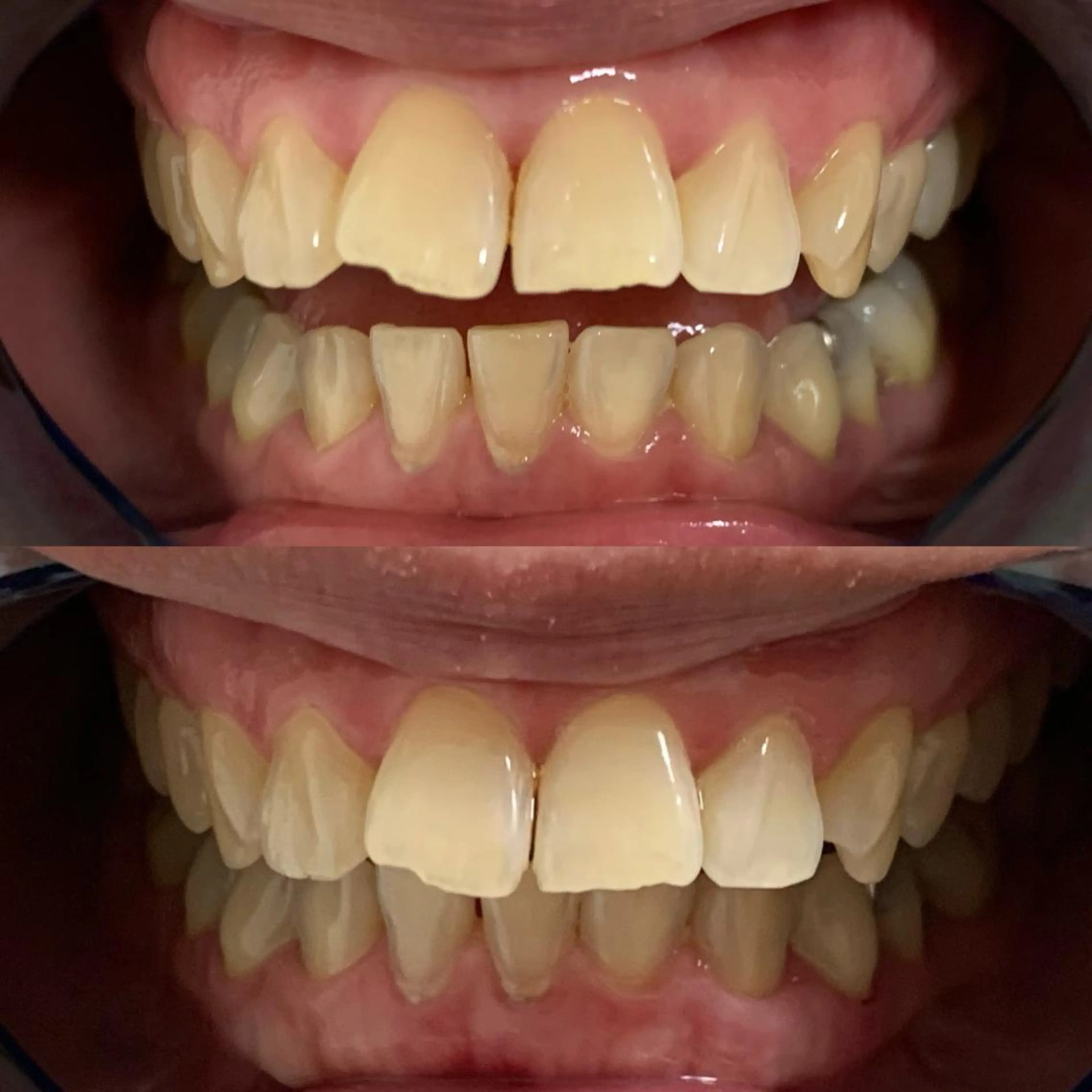 その他 藤本 真心のネイルデザイン