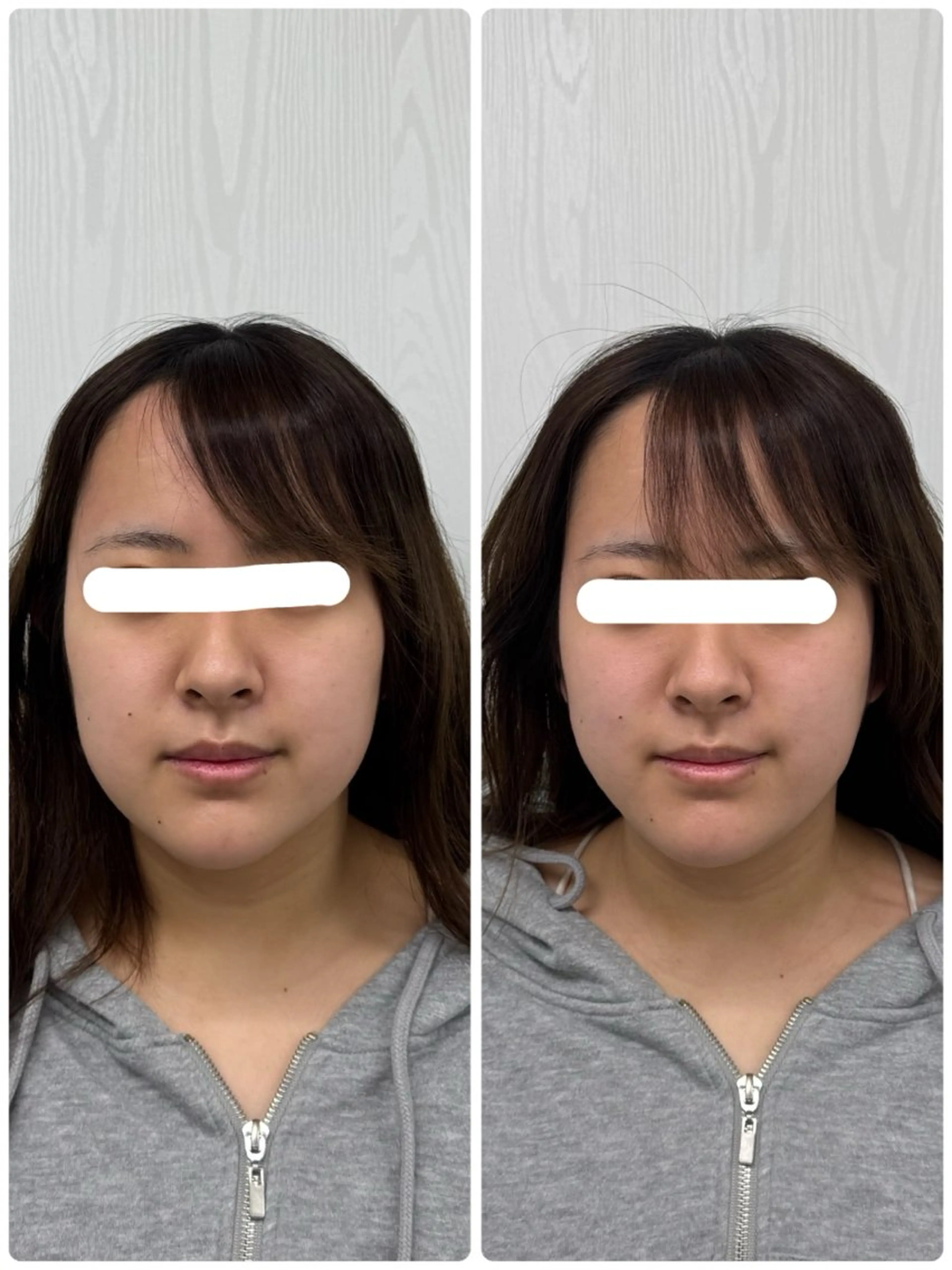 美容鍼×小顔矯正 ×美容整体　浜川泰仁のエステ・リラクイメージ