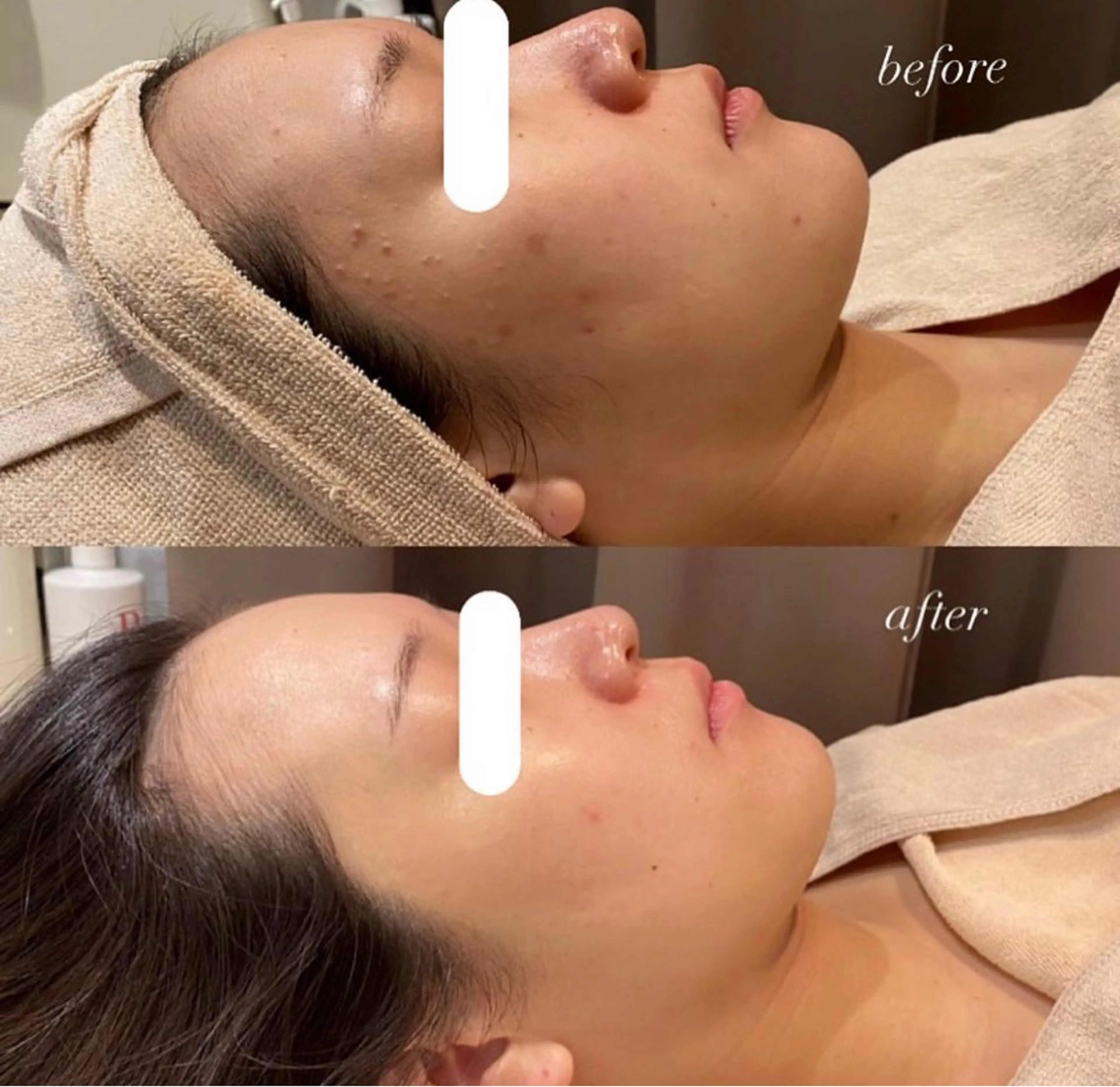 エステ mumu 野々市若松店所属・mumu Rちゃんのエステ・リラクイメージ