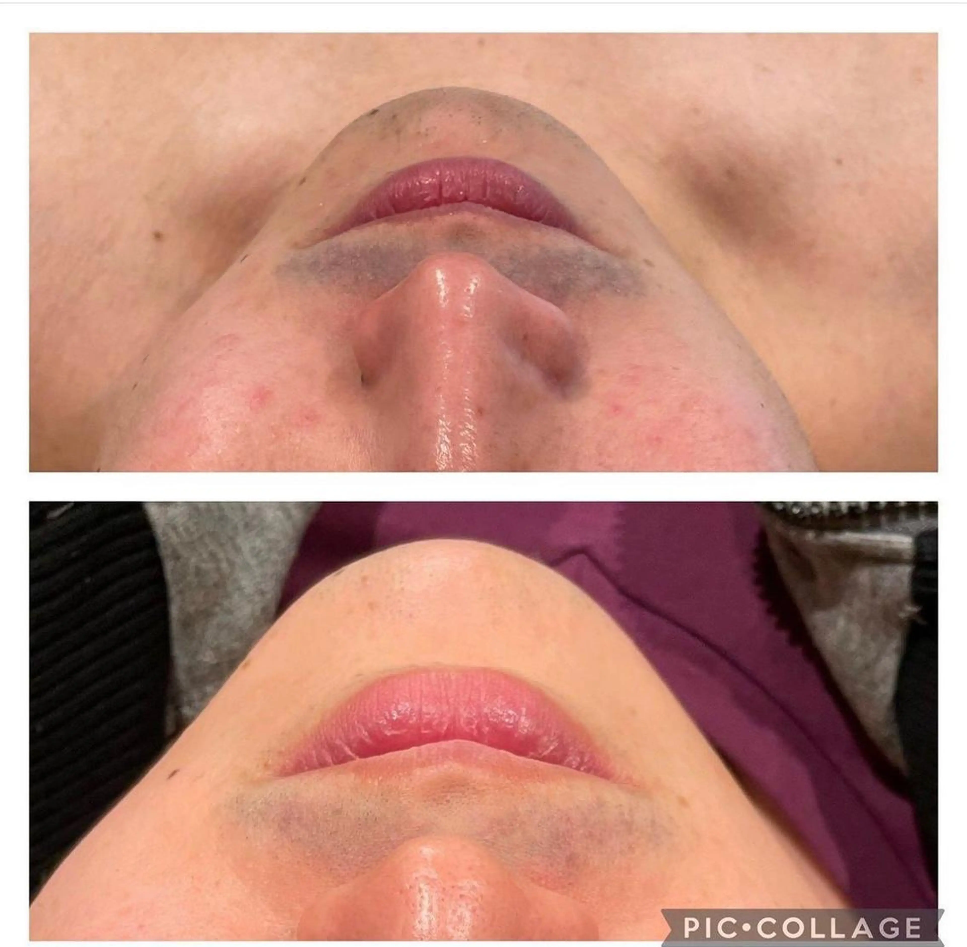 メンズ マドンナ 富士店のエステ・リラクイメージ