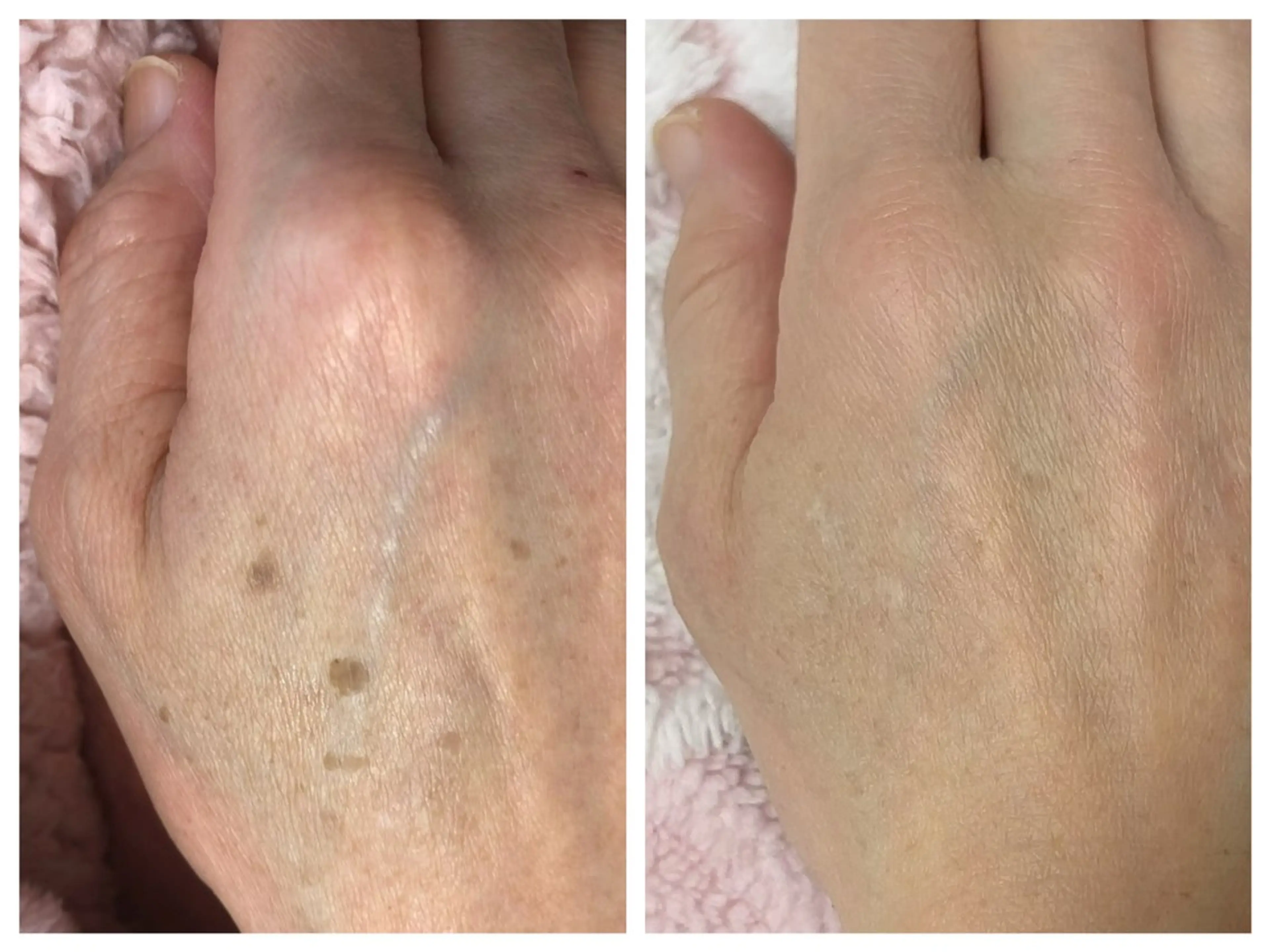 顔専門エステ プリエールビューティのエステ・リラクイメージ