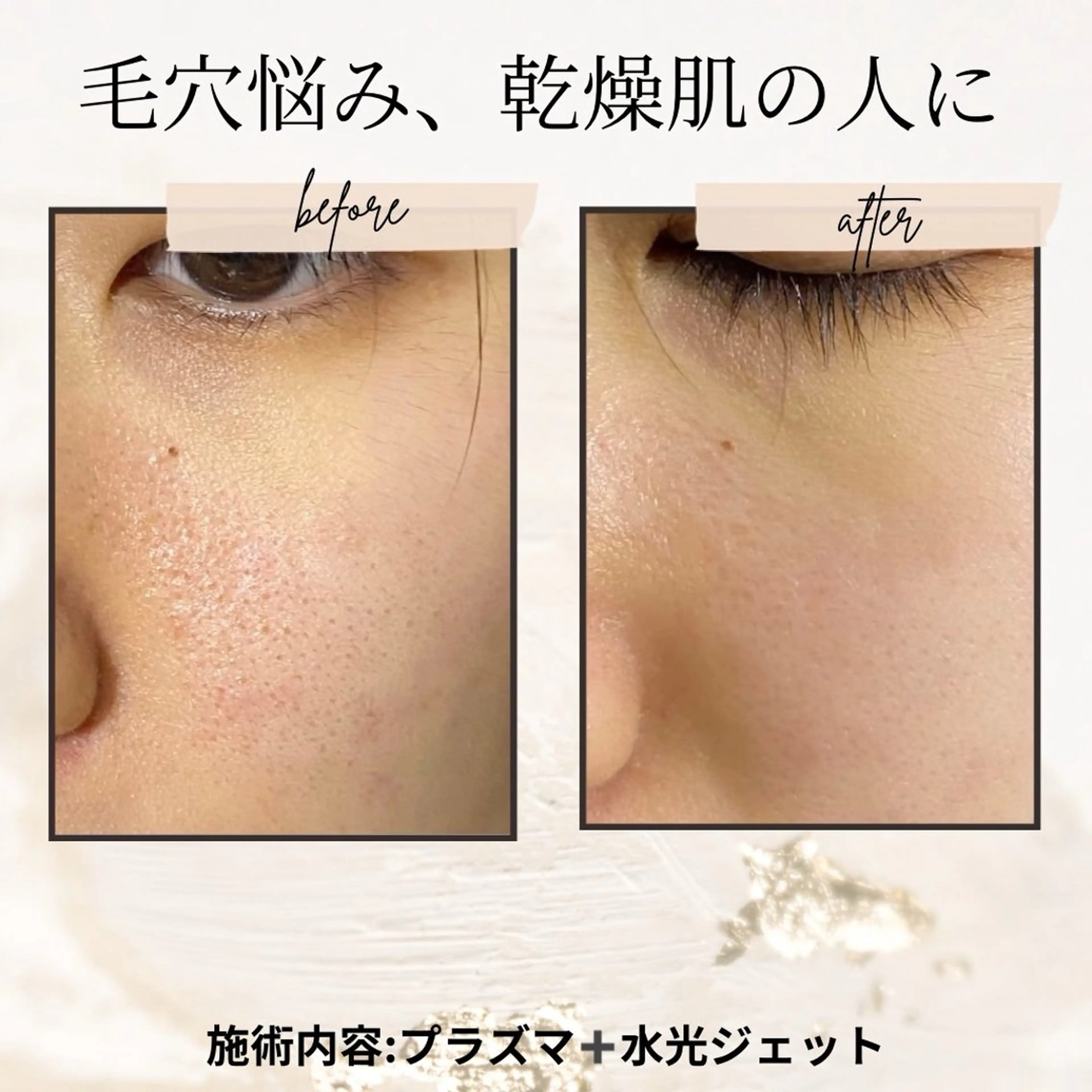 カラー エステ aliaハイフ&水光ジェットサロン所属・aliaハーブ水光店 エステティシャン募集のエステ・リラクイメージ