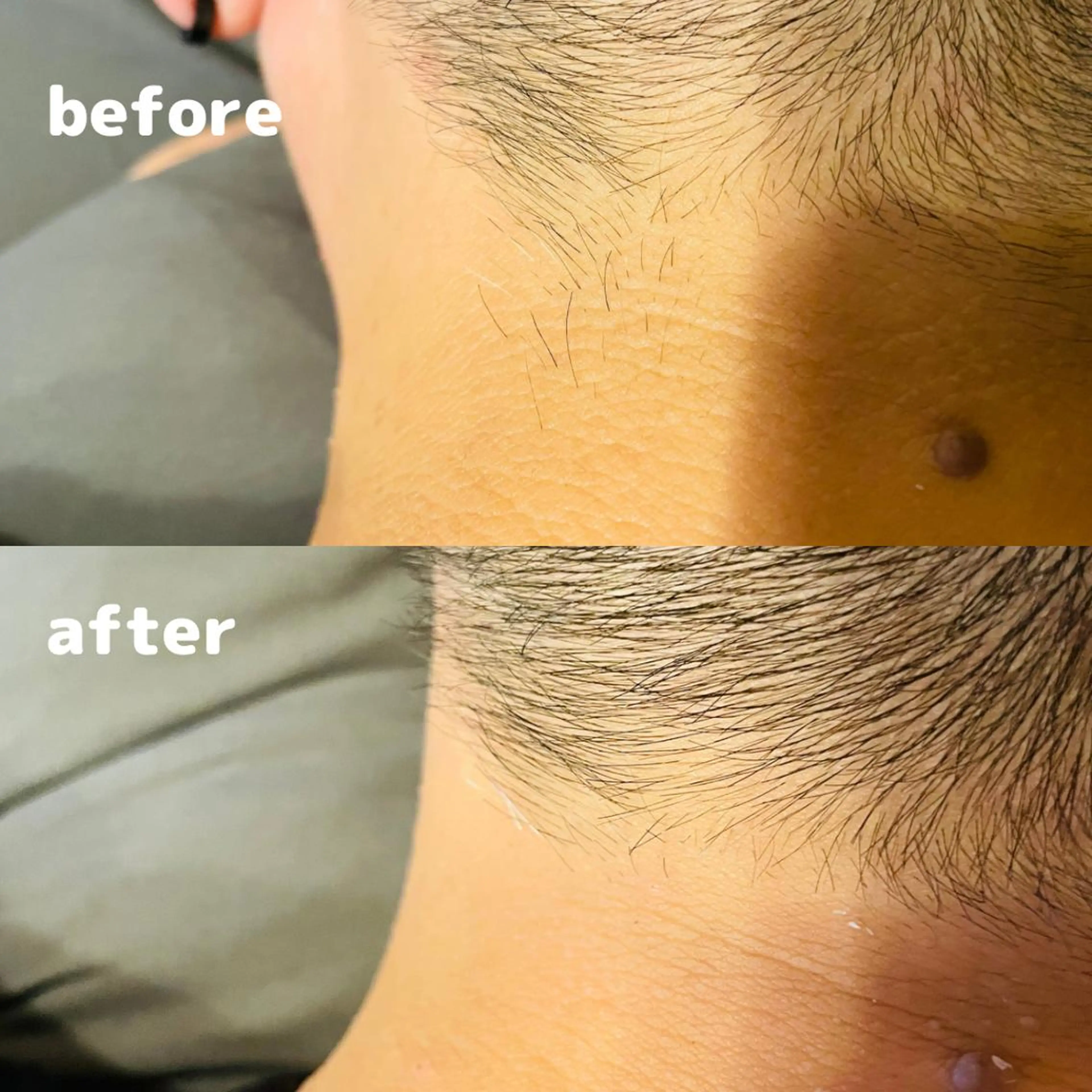 メンズ Pono所属・Pono （ポノ）のエステ・リラクイメージ