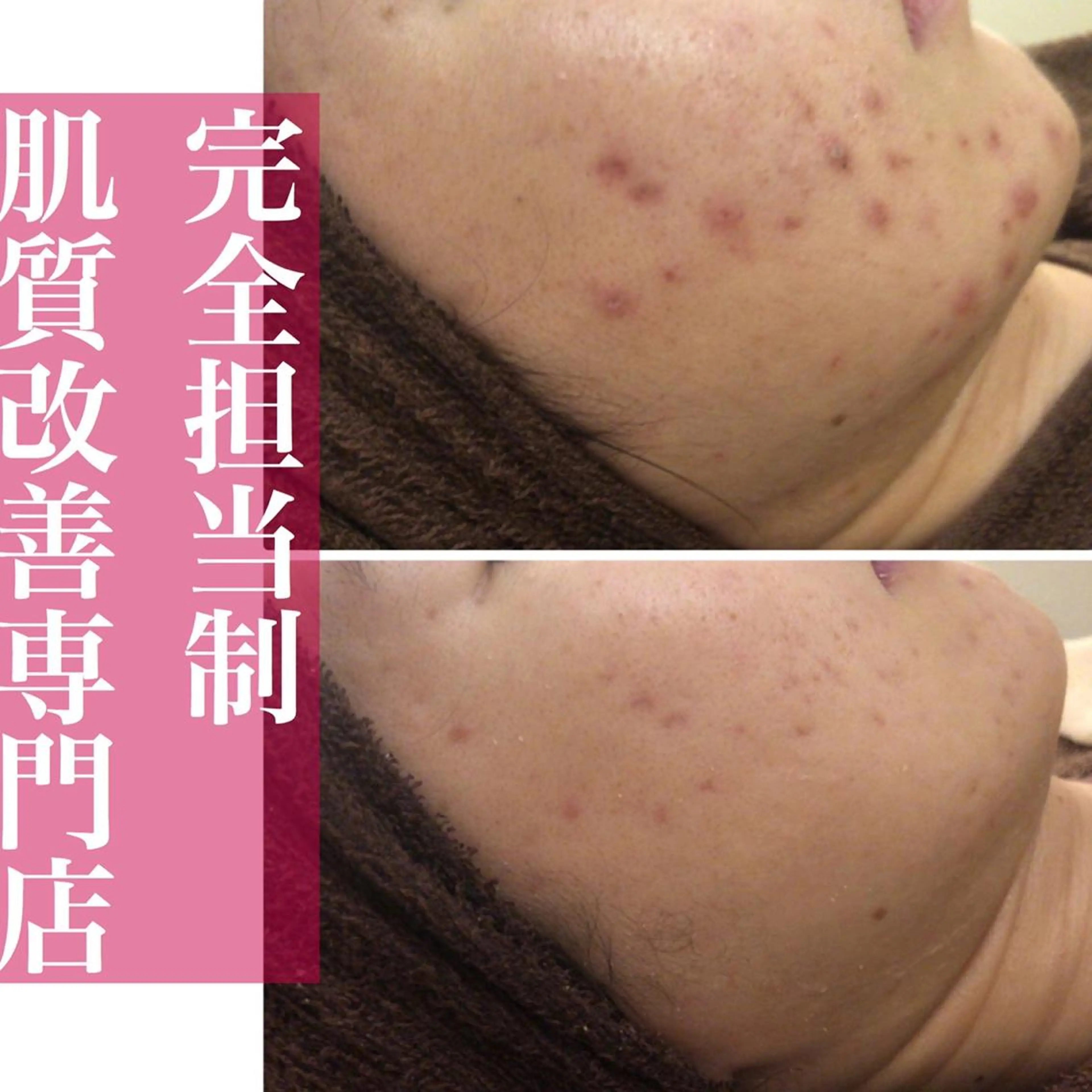 ミディアム カラー パーマ ヘアアレンジ メンズ キッズ ネイル マツエク・マツパ アイブロウ ニキビ・肌質改善専門 ♡人生が変わるサロンのエステ・リラクイメージ